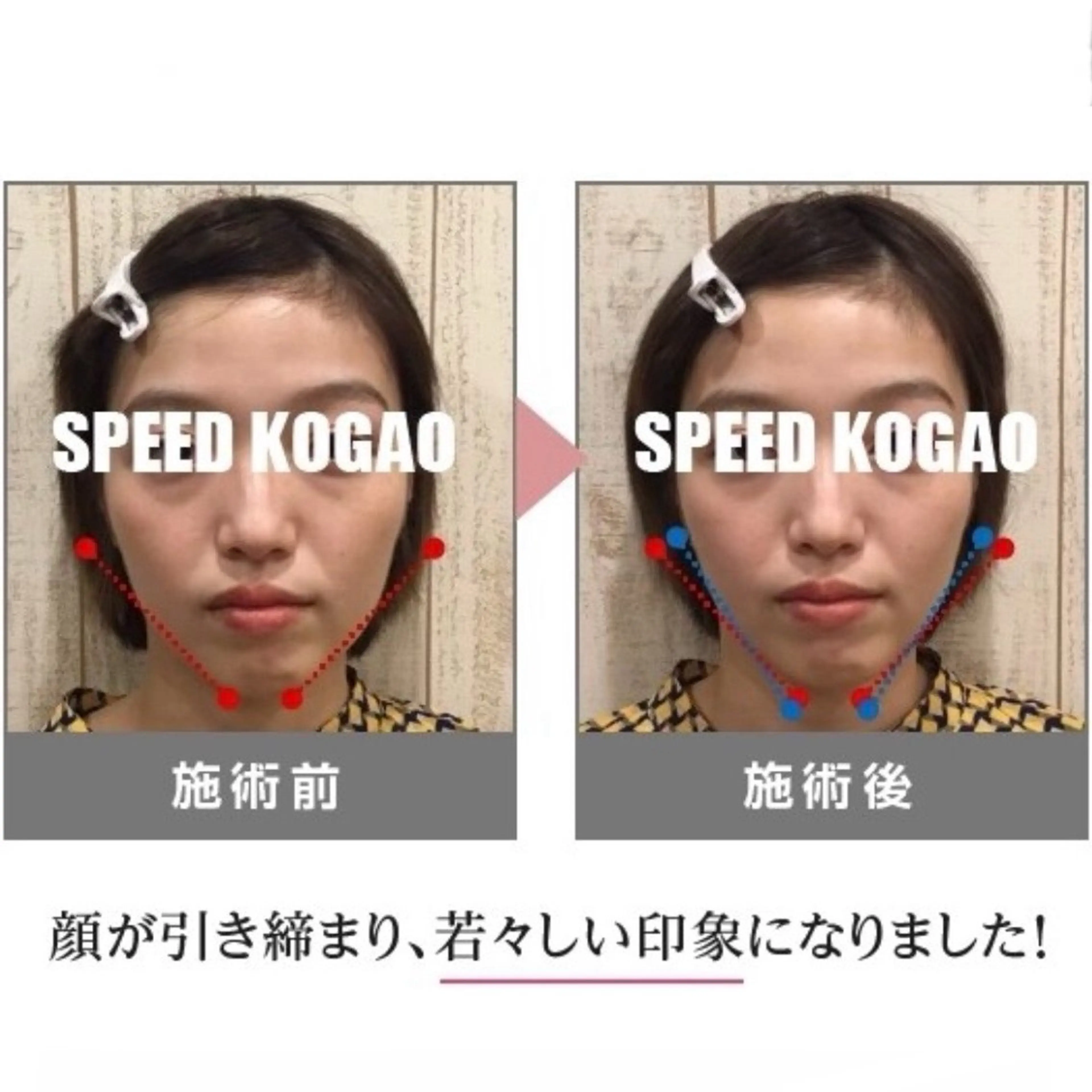 エステ リラク 小顔矯正Speed KOGAO渋谷本店のエステ・リラクイメージ