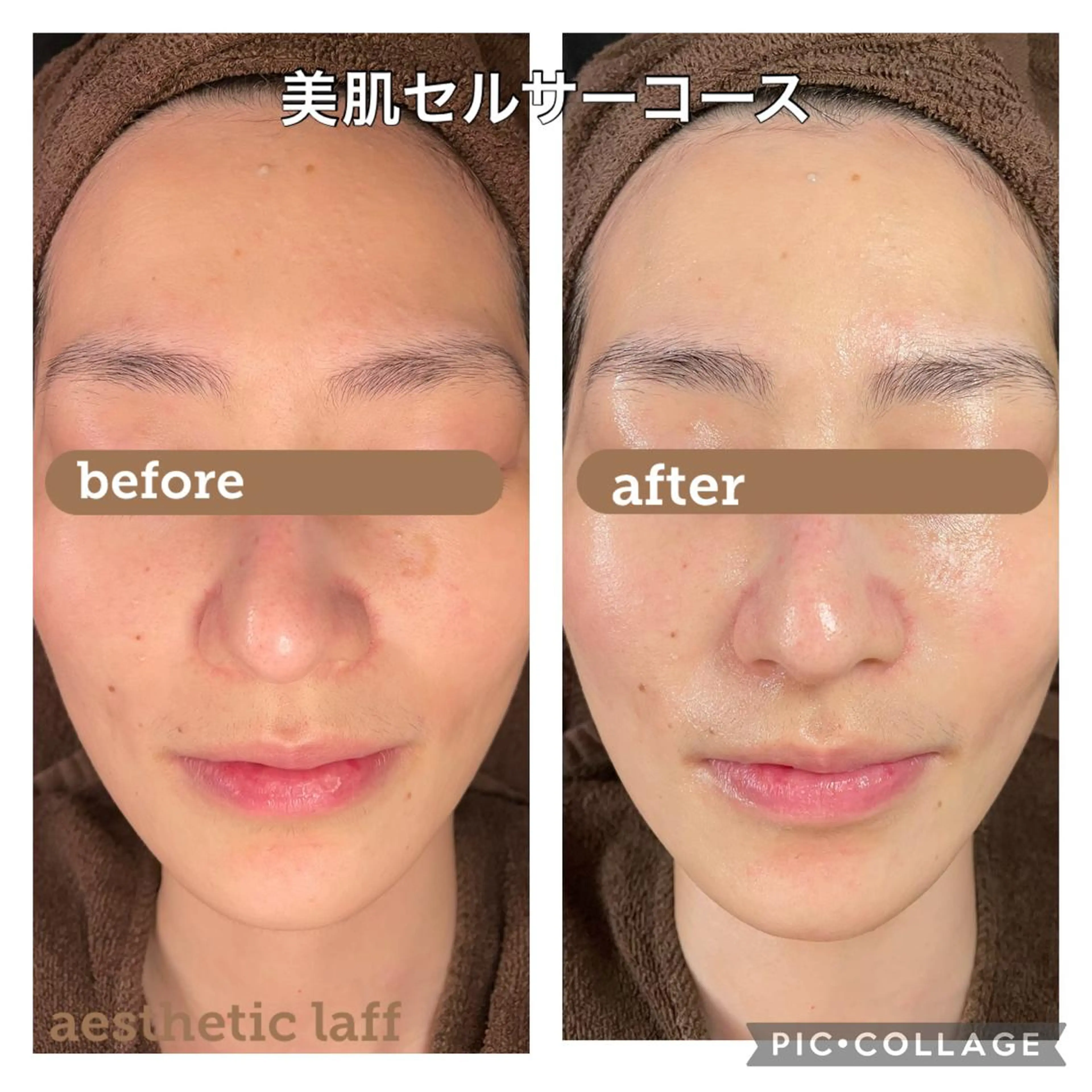 美肌作りのサロン 山村亜美のエステ・リラクイメージ