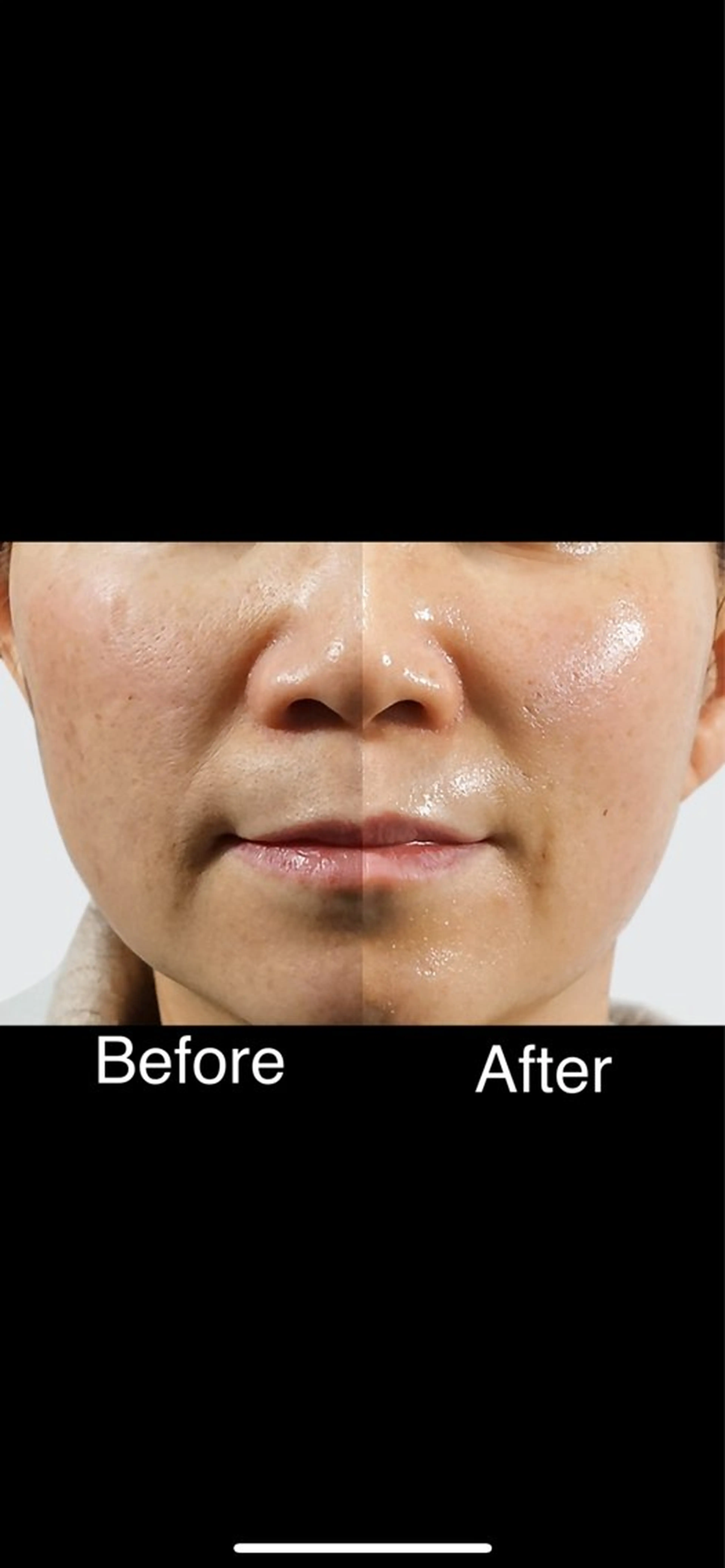 くすみ・シミ改善/ ララピール/光フォトのその他イメージ