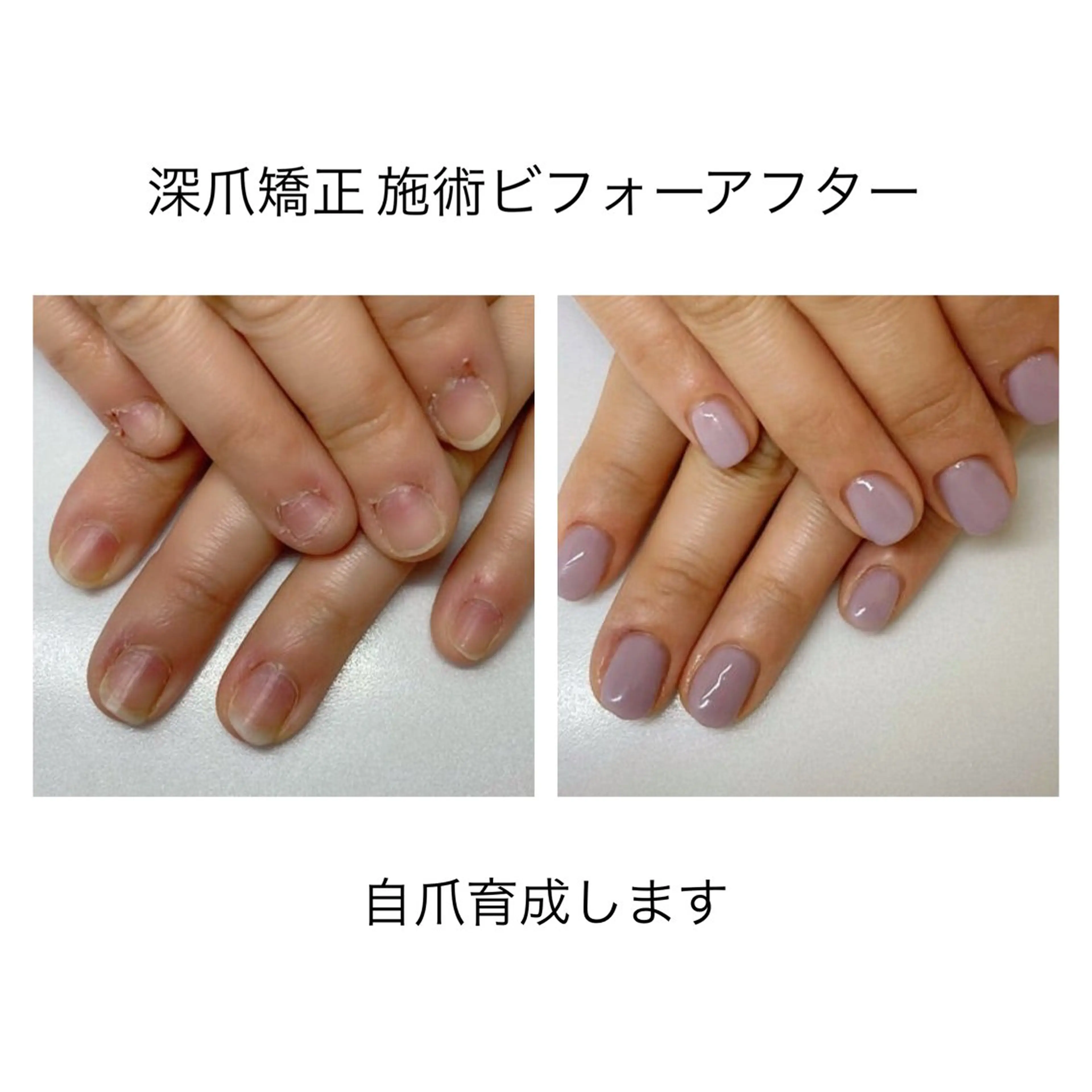 ネイル ネイルサロン アリュームのネイルデザイン