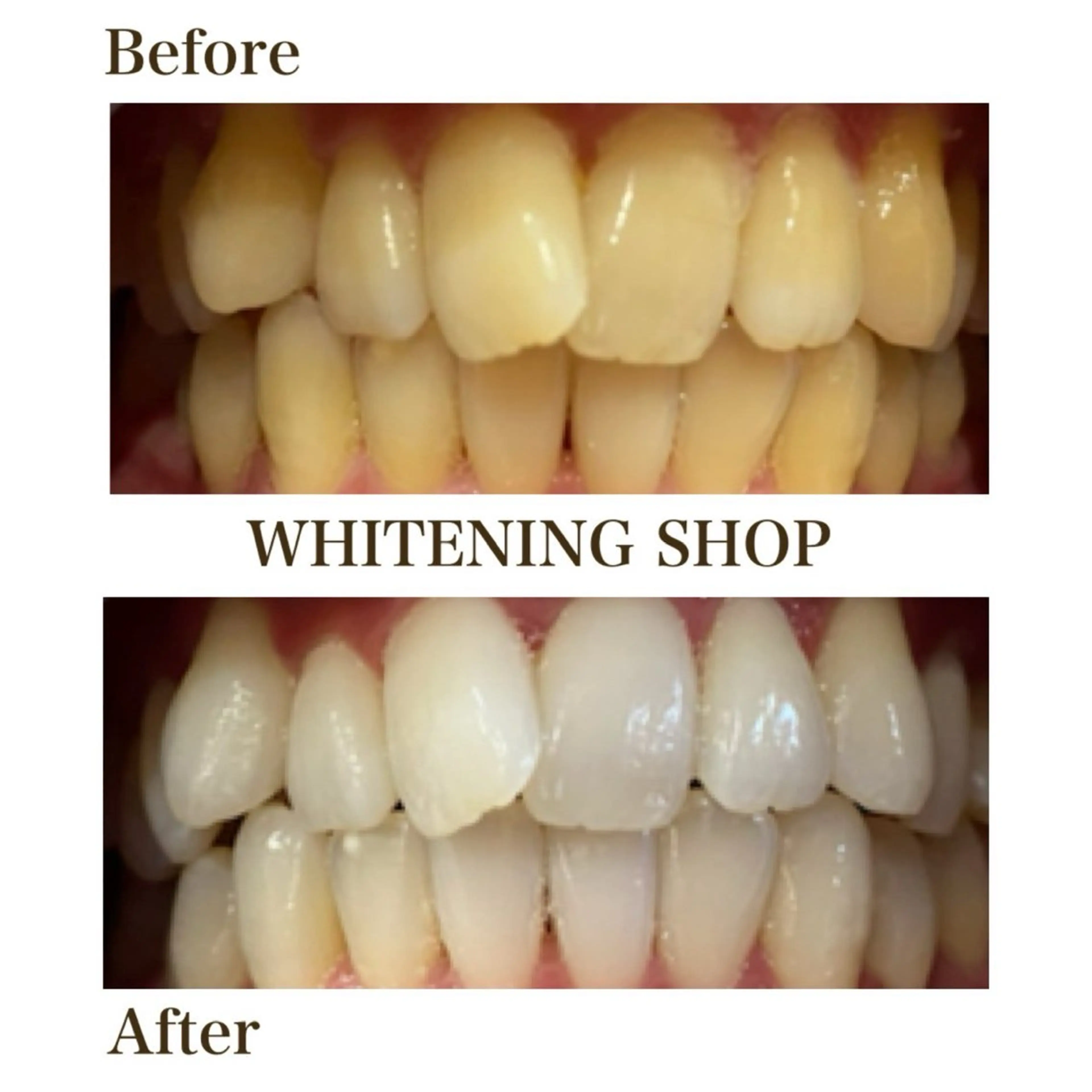 ホワイトニング ショップ葵区静岡駅店のその他イメージ