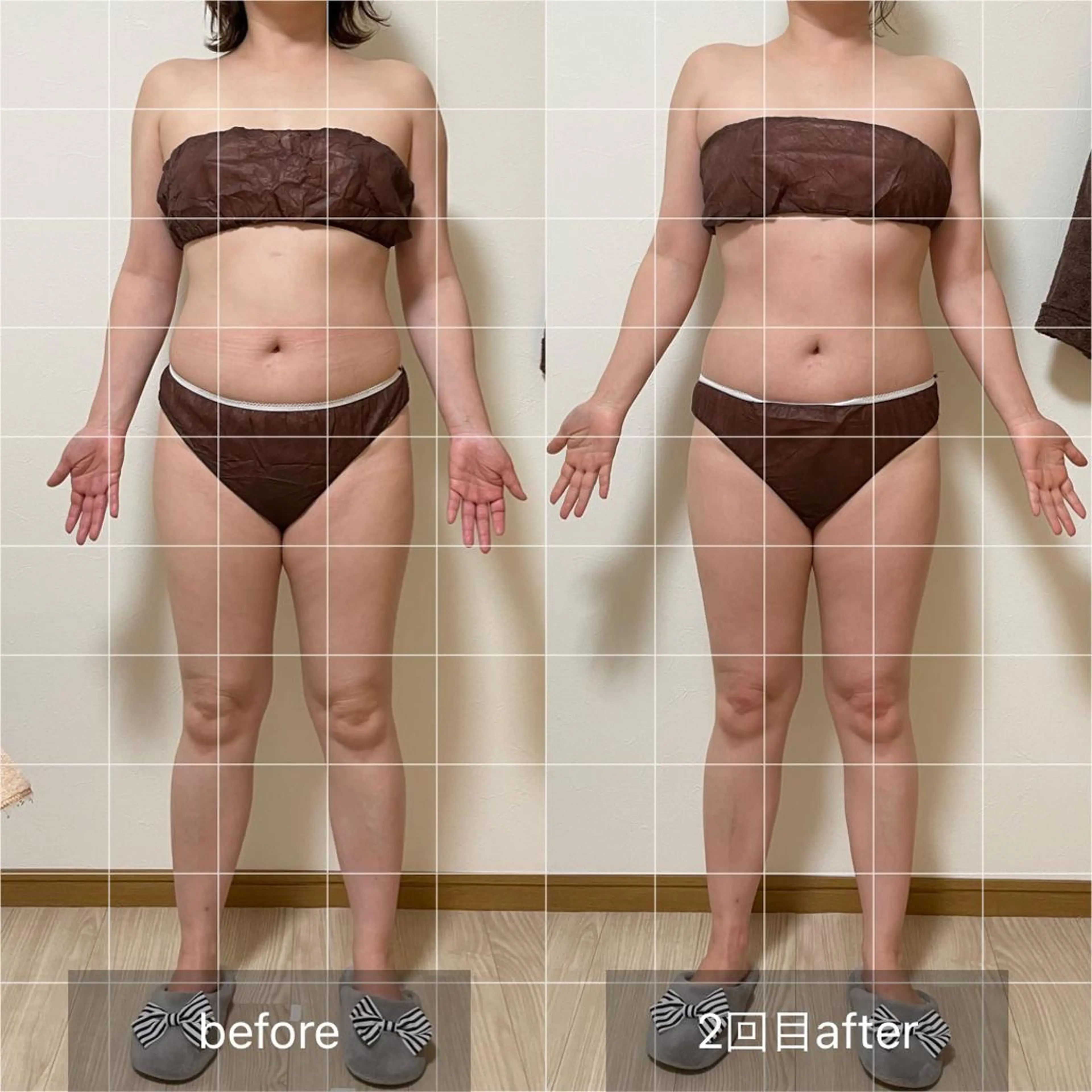 未病ケアサロン　EMINY所属・未病ケアサロン EMINY☺︎勝俣のエステ・リラクイメージ