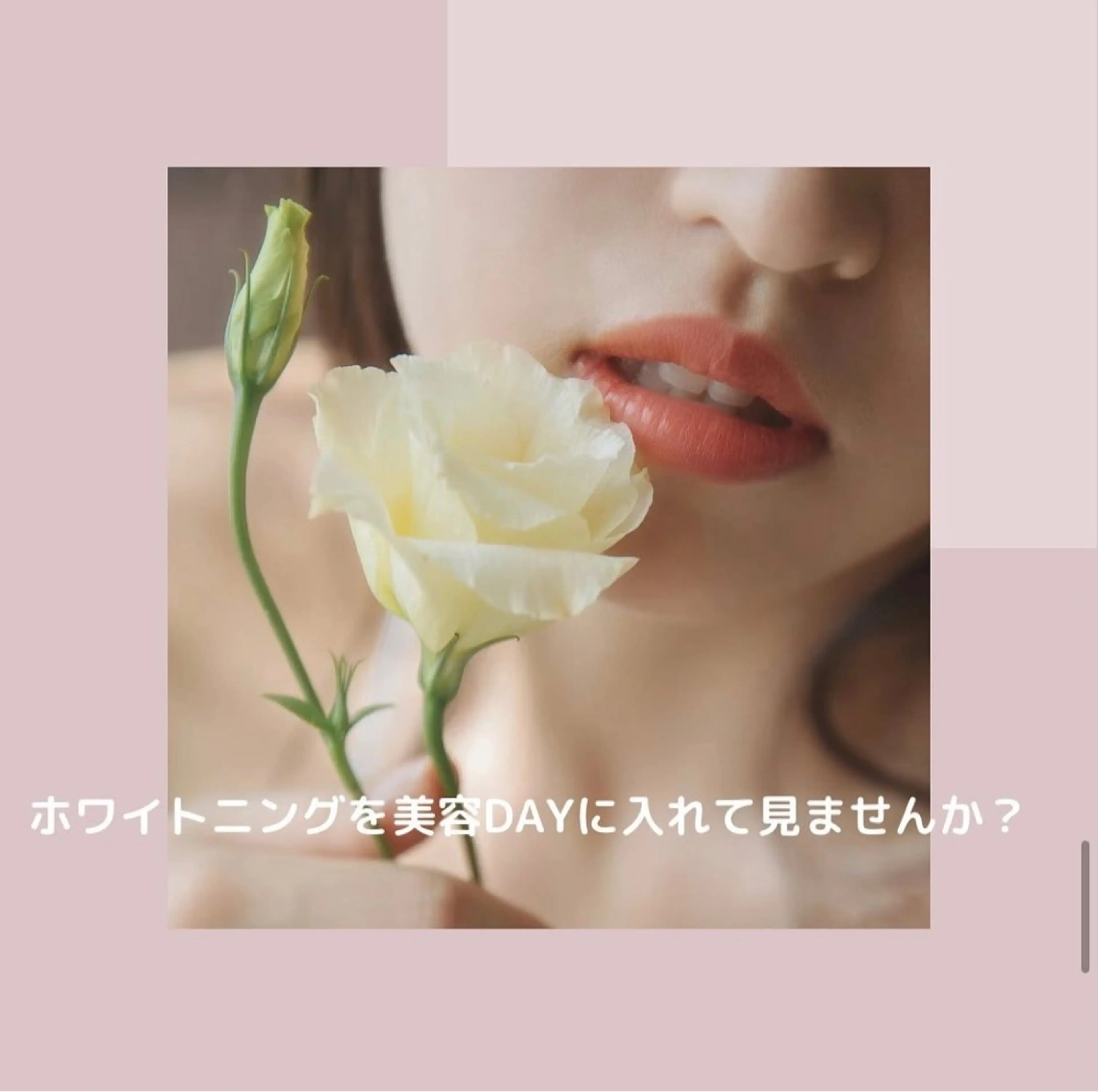 ホワイトニング ショップ伊丹店のその他イメージ