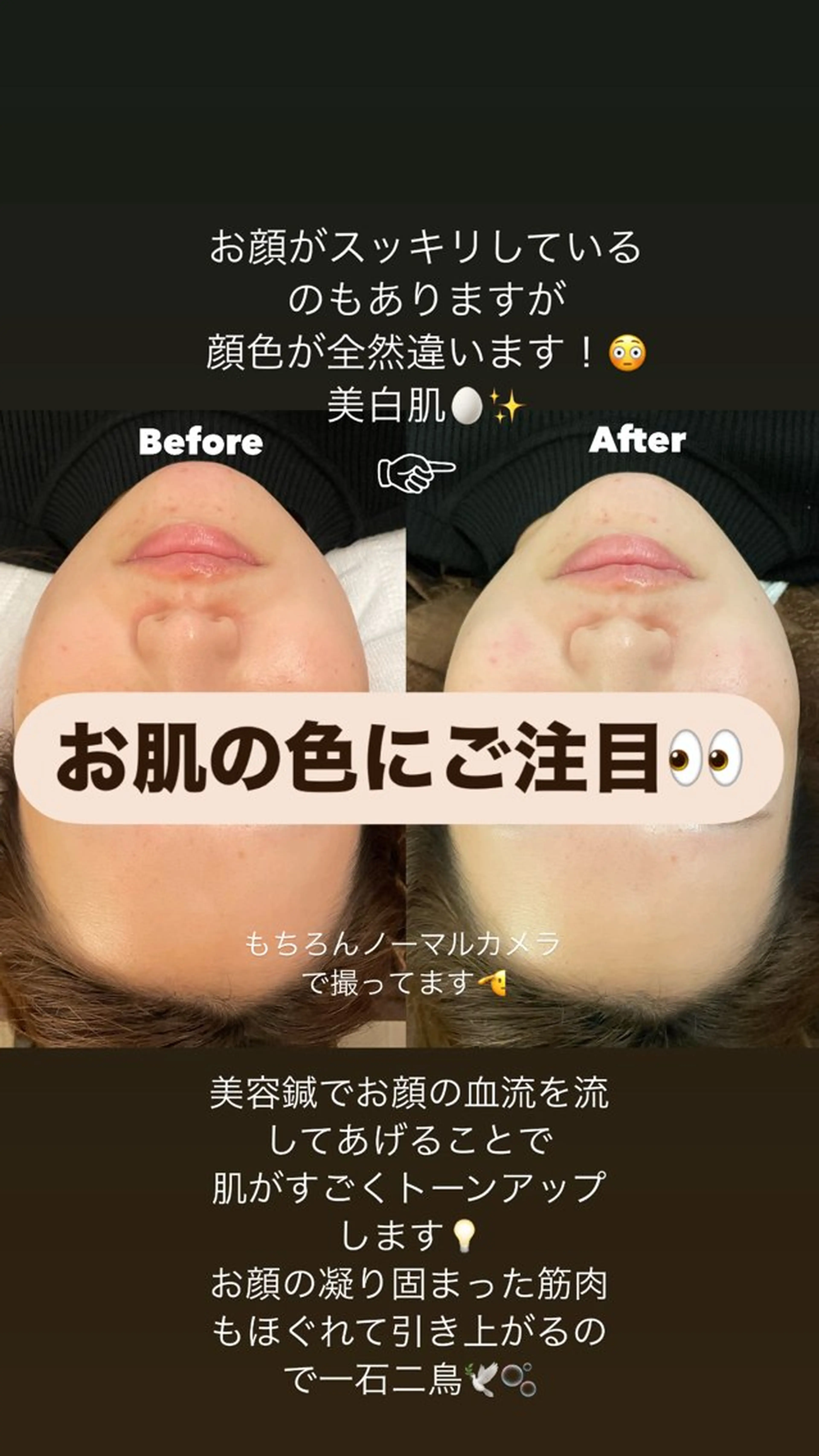 美容鍼/鍼灸 ここみ鍼灸院のエステ・リラクイメージ