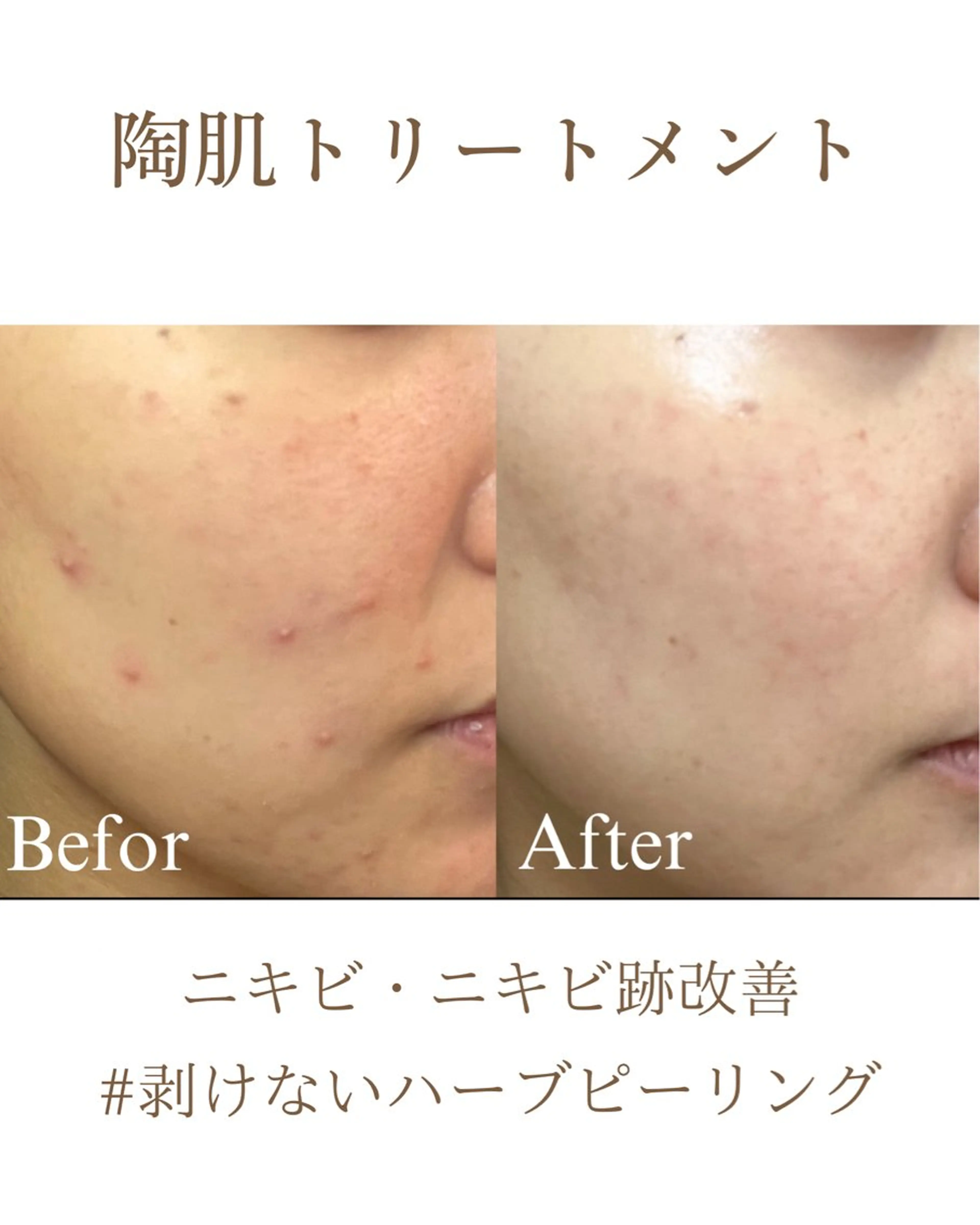 エステ フェイシャルサロンLusis所属・肌質改善専門サロン Lusisのエステ・リラクイメージ