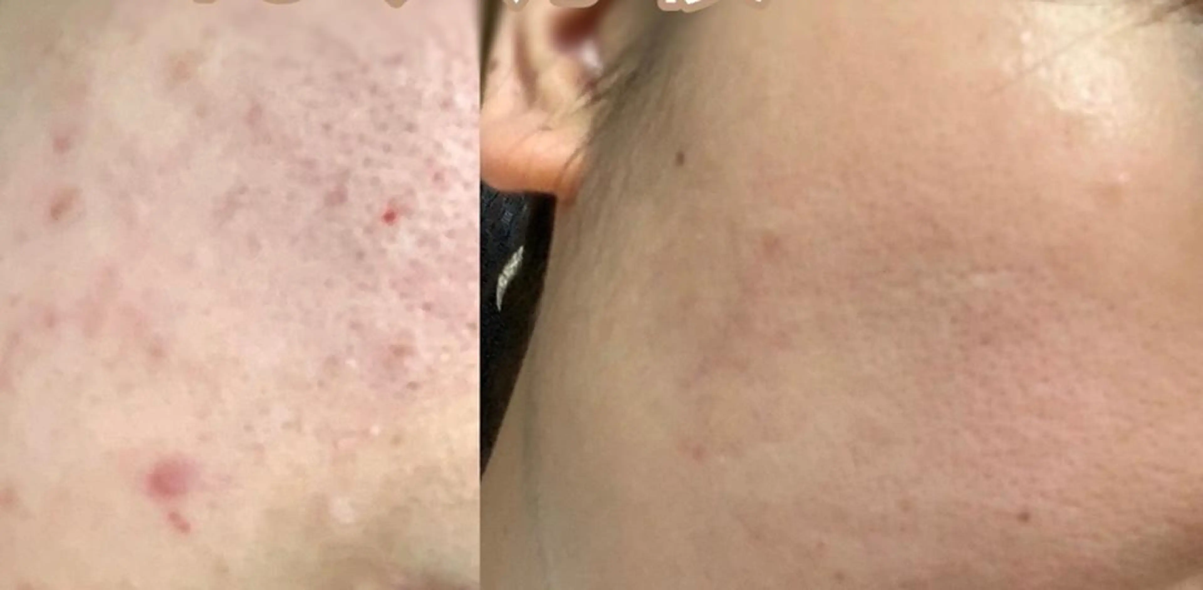 朝重い人専用 肩甲骨調整のエステ・リラクイメージ