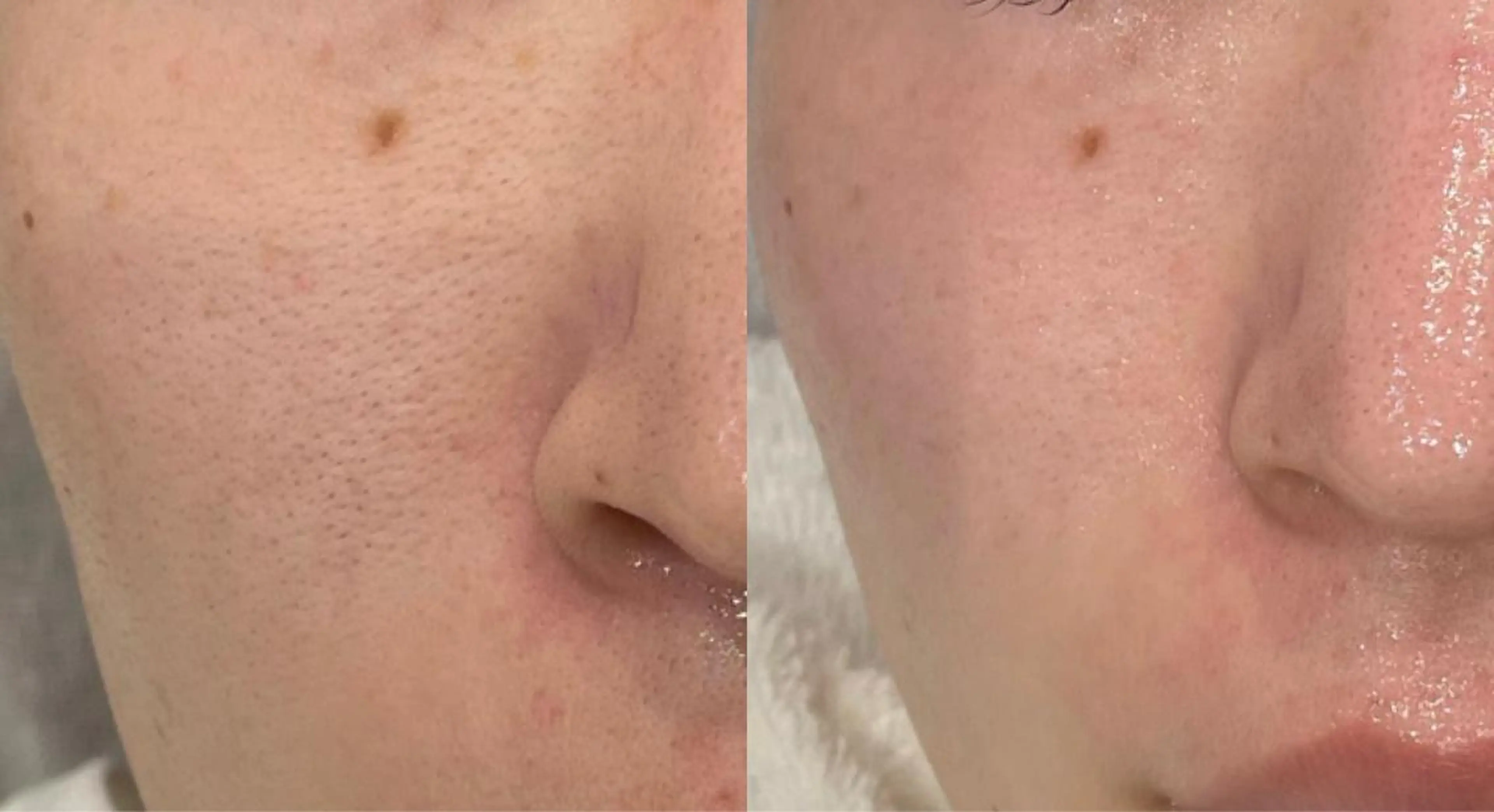 エステ 小林 玲菜のエステ・リラクイメージ