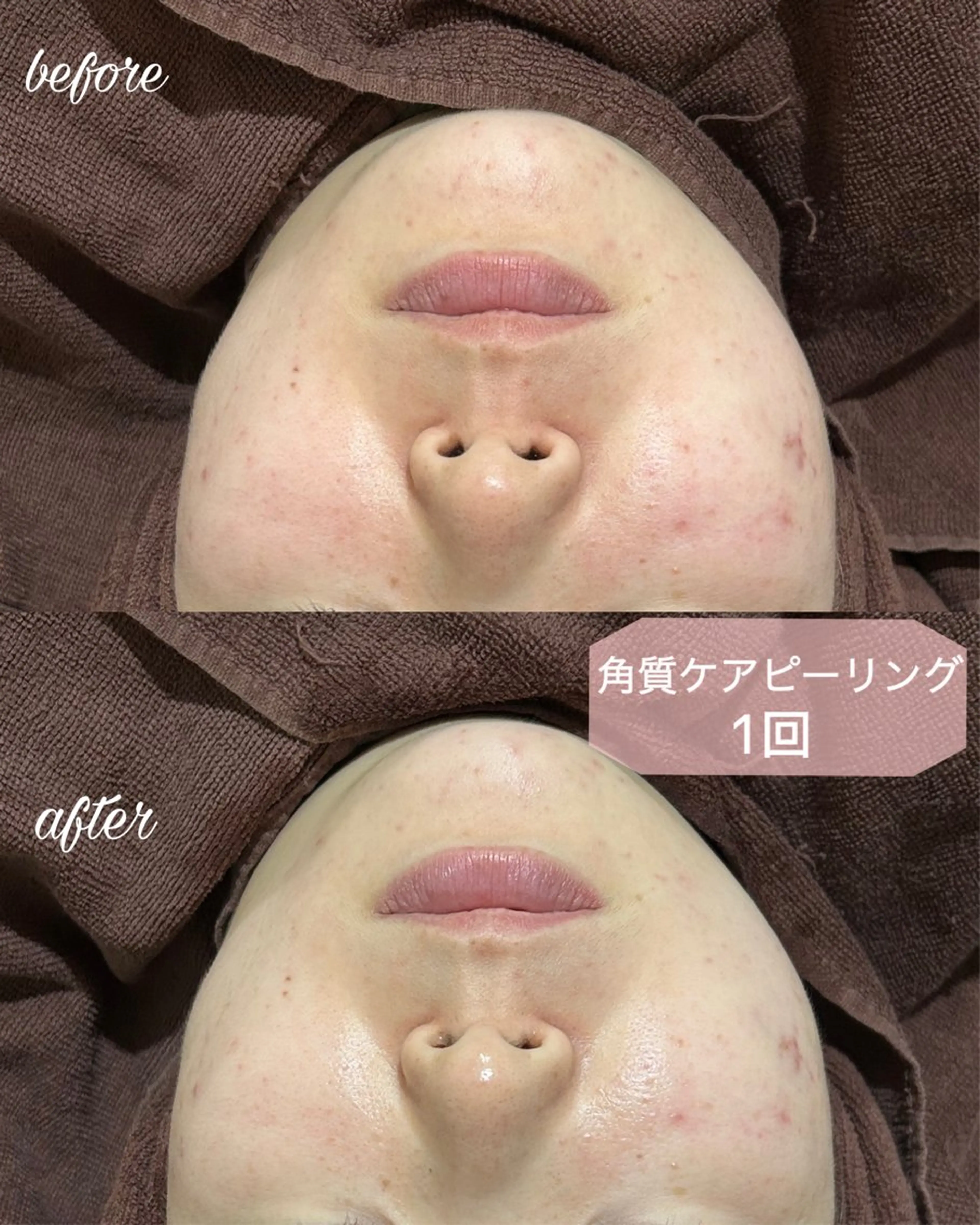 マツエク・マツパ アイリッドアップパーマ マツパ まつげ/整体/にきび ・アトピー専門サロンのマツエク・マツパデザイン