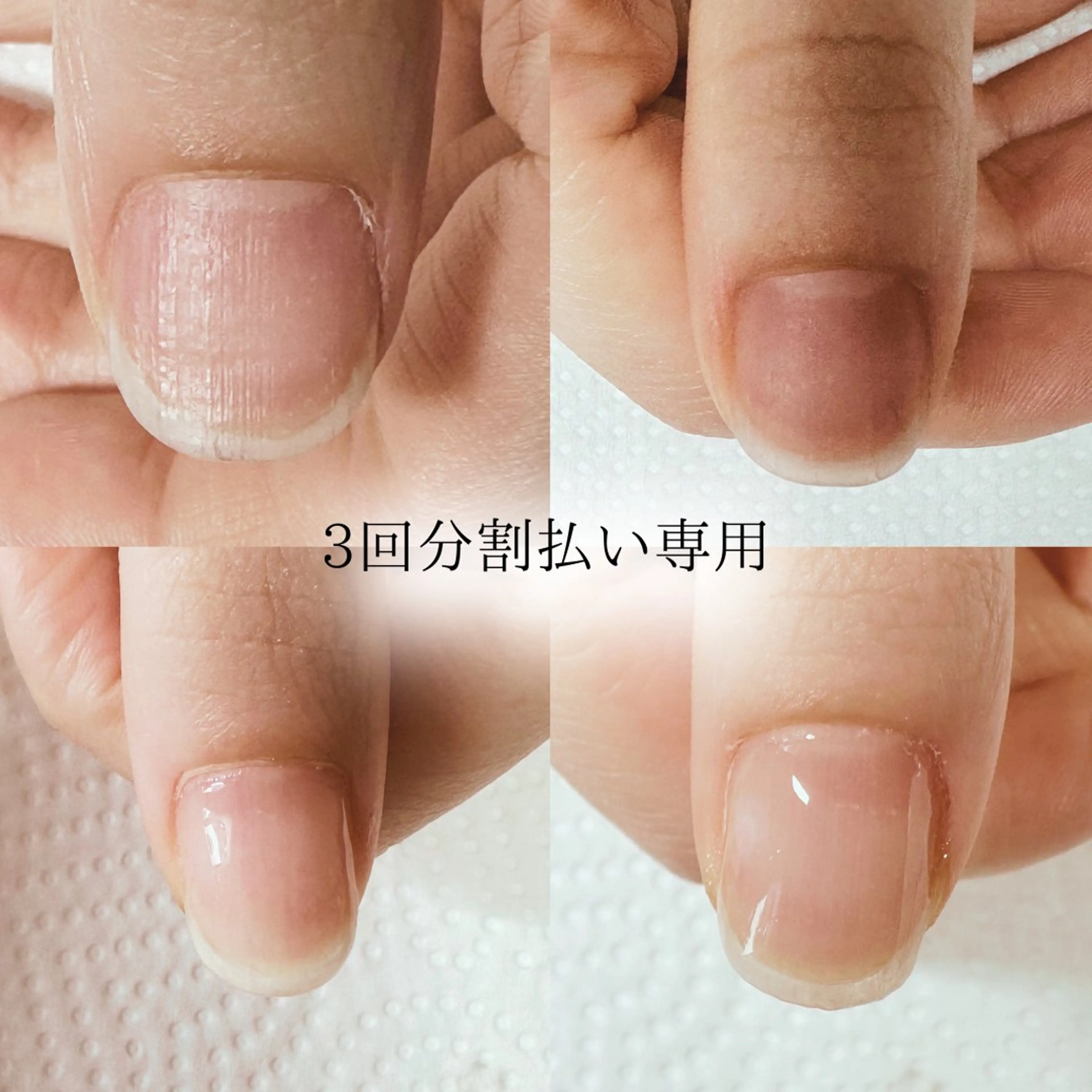 【クリアジェルでピンクの部分を伸ばす】分割払い自爪育成コース🎁15000円相当のホームケアセットプレゼント🎁の写真