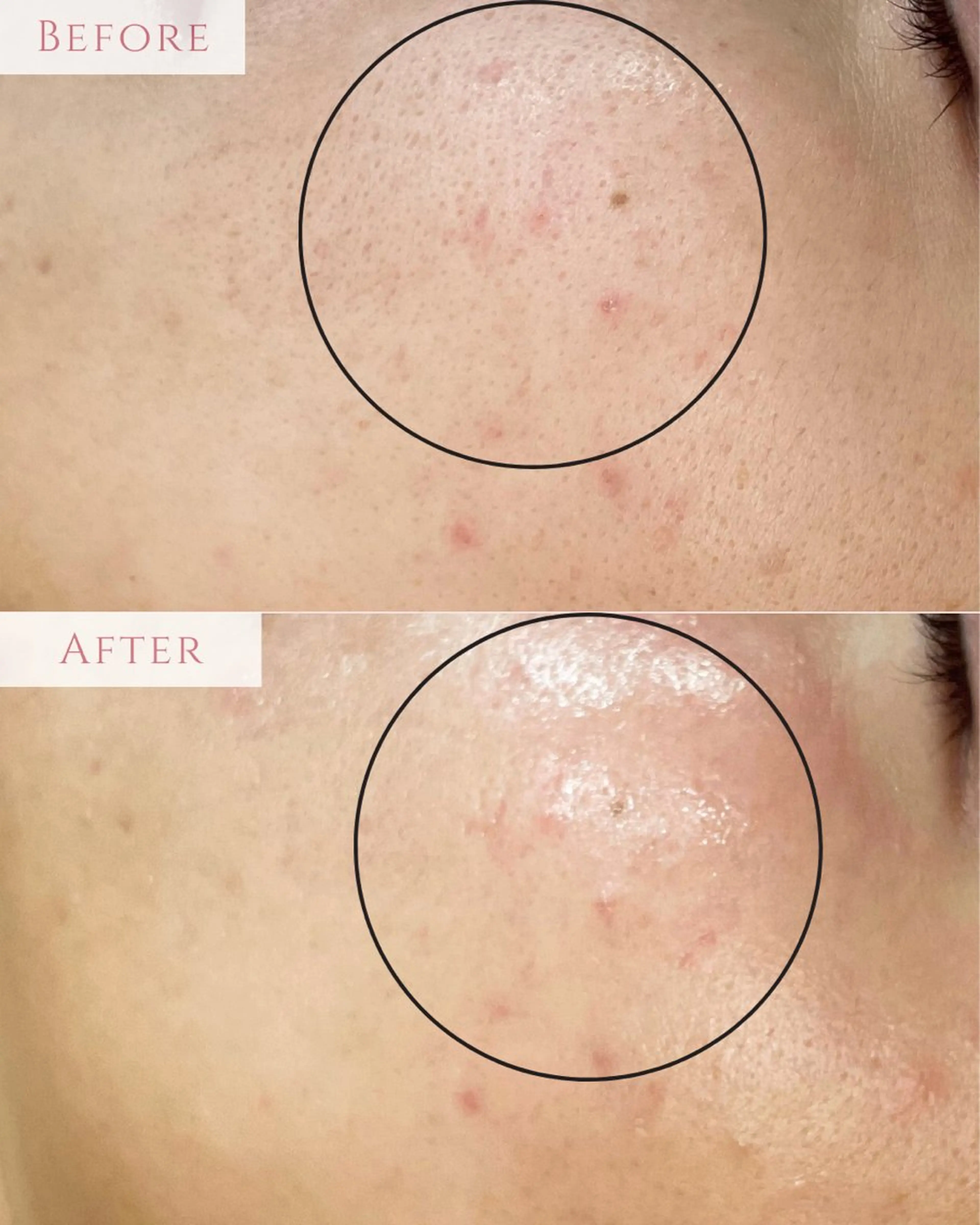 エステ 肌質改善専門サロン Bellmi/心斎橋のエステ・リラクイメージ