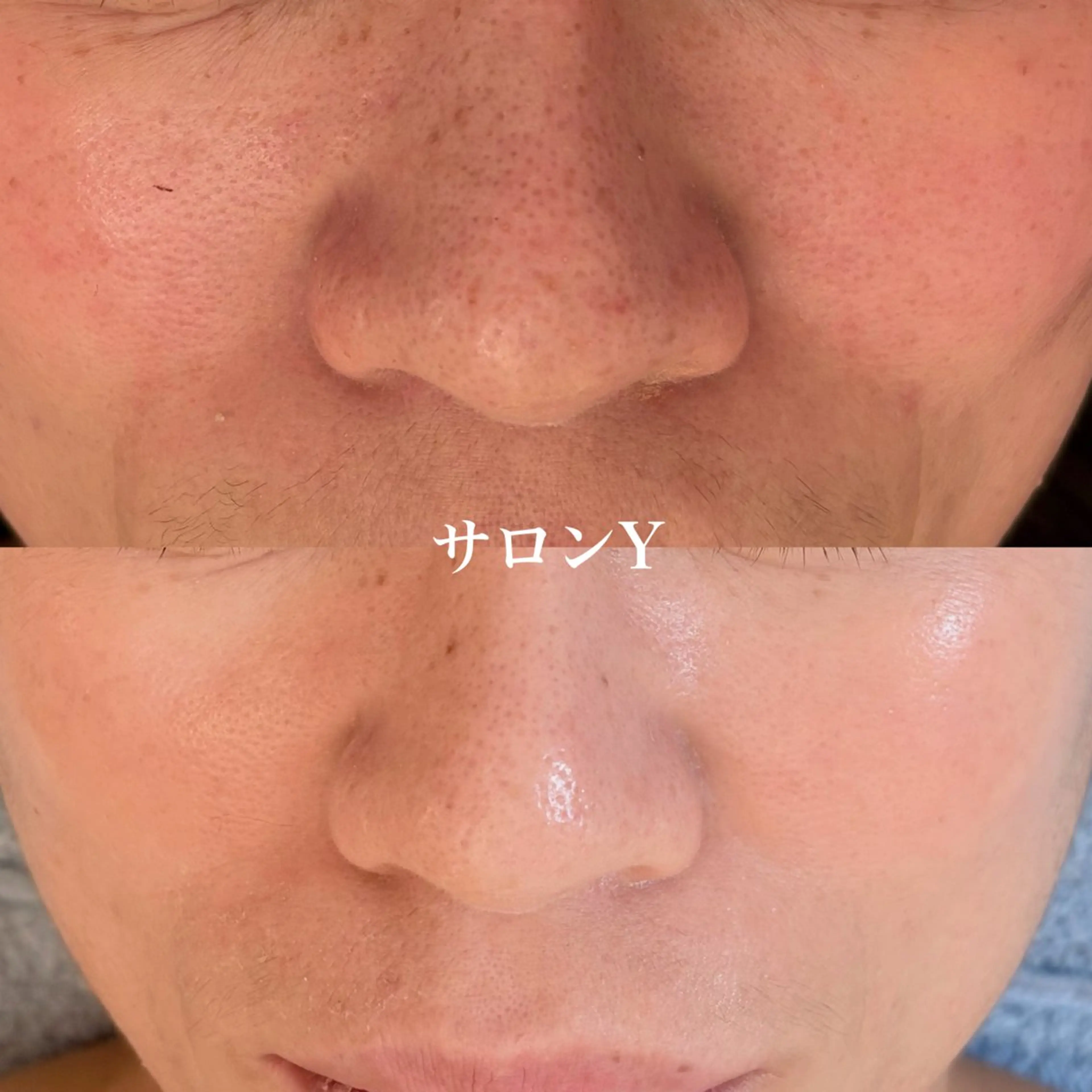 エステ リラク グリーンピール専門店 サロンY【大阪】のエステ・リラクイメージ