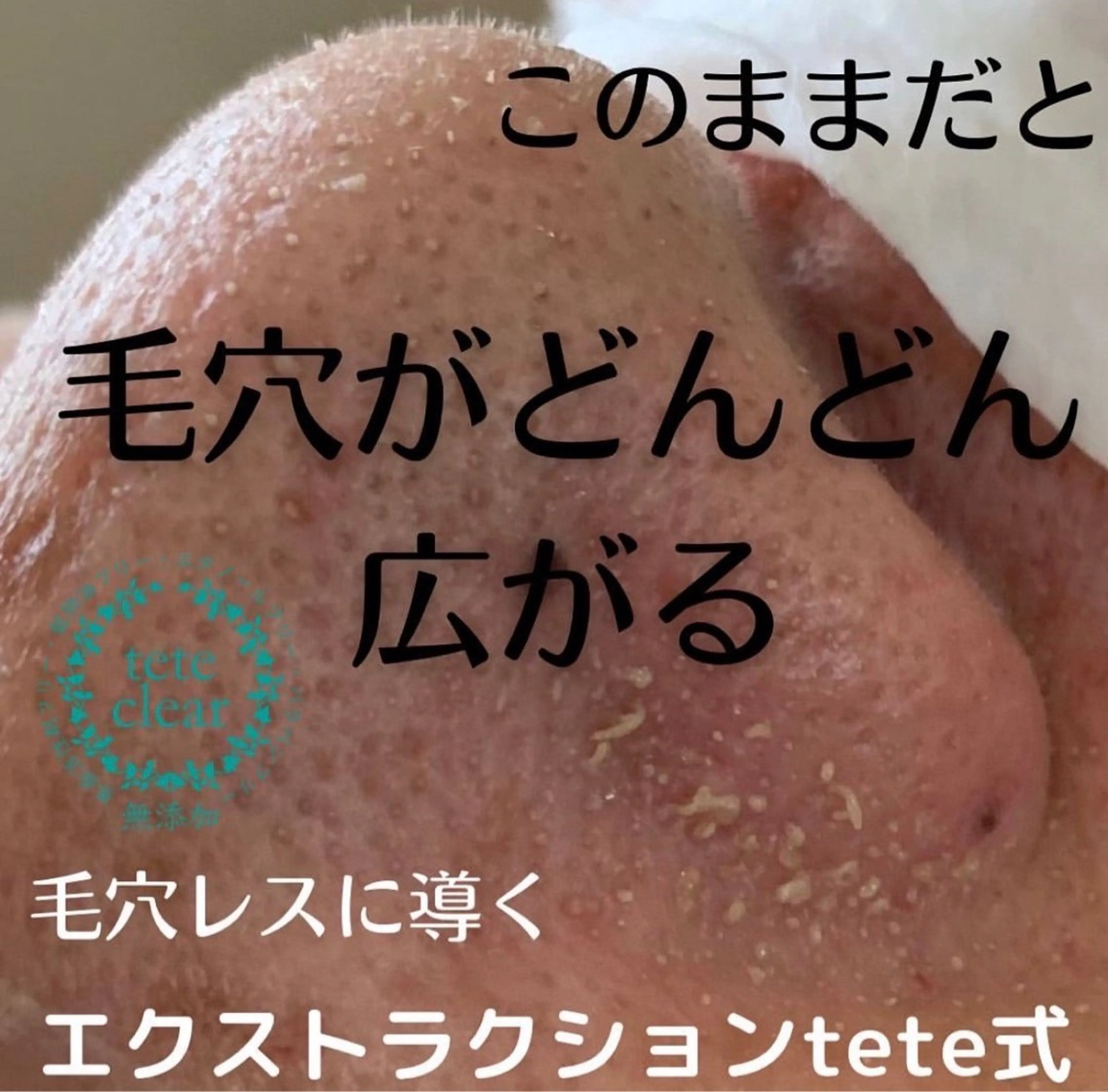 【毛穴専門店】 瑞江|yukaのエステ・リラクイメージ