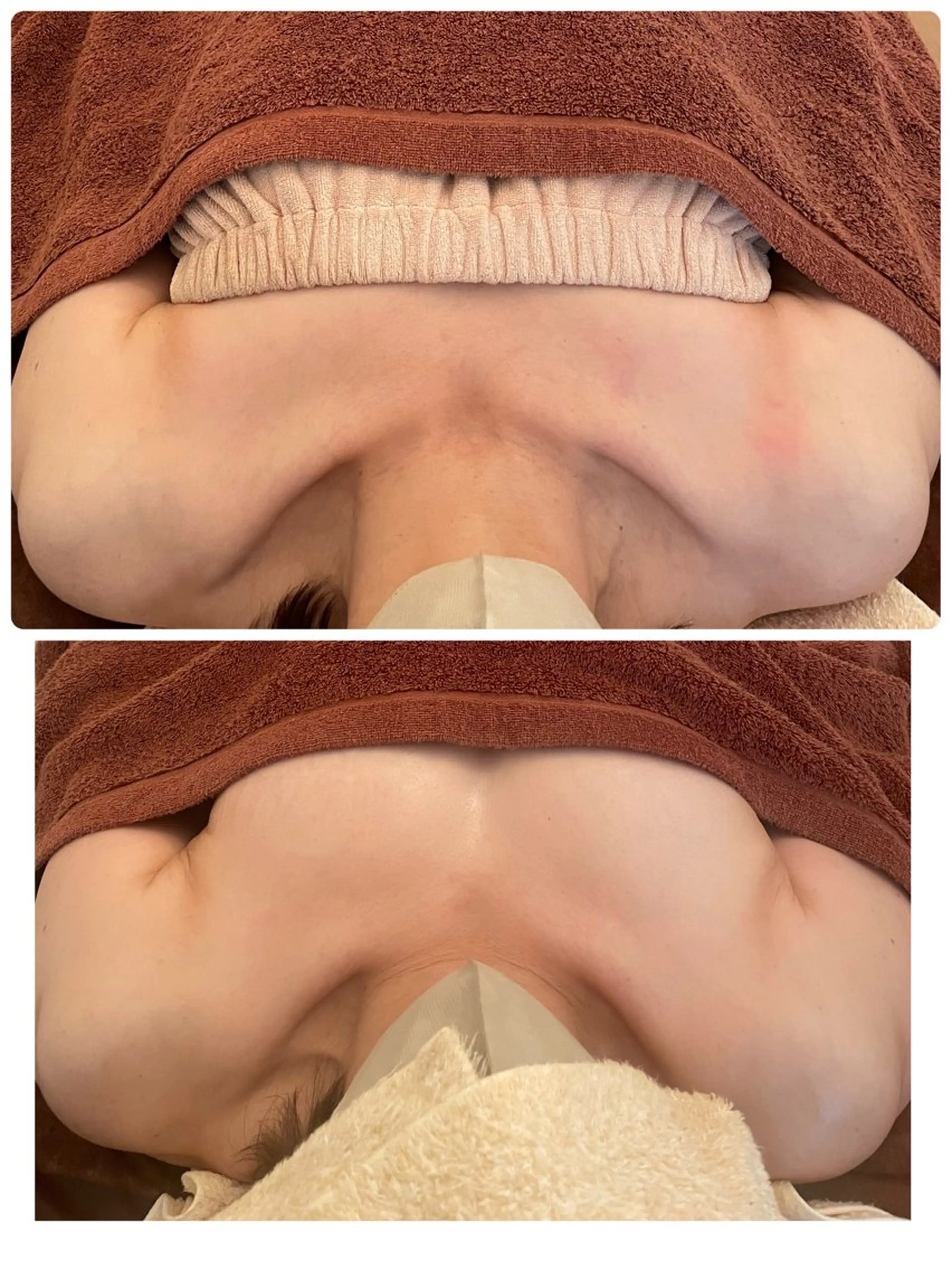 全身整え、ふっくらバストの写真