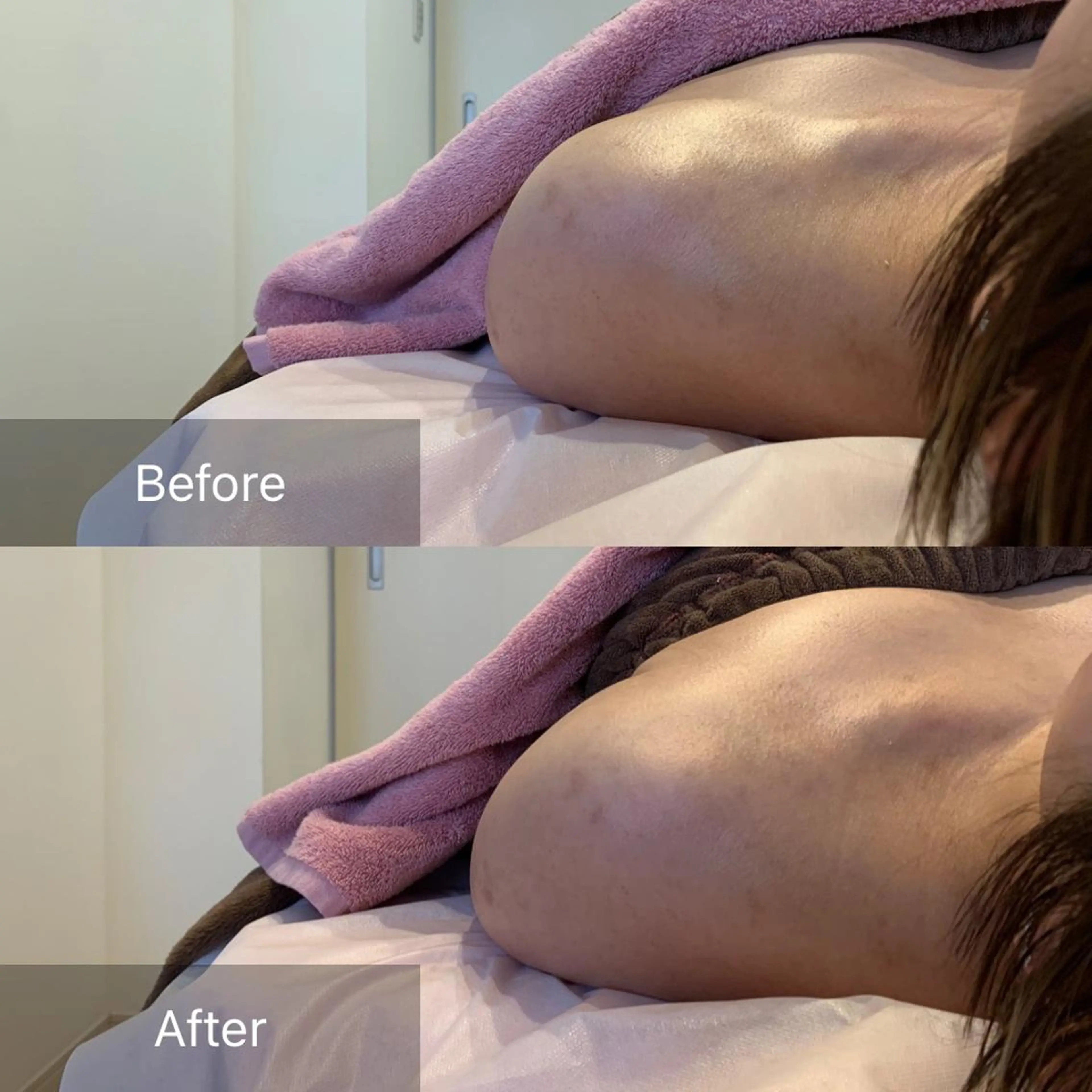 【頭痛、睡眠改善】 salon RUUのエステ・リラクイメージ