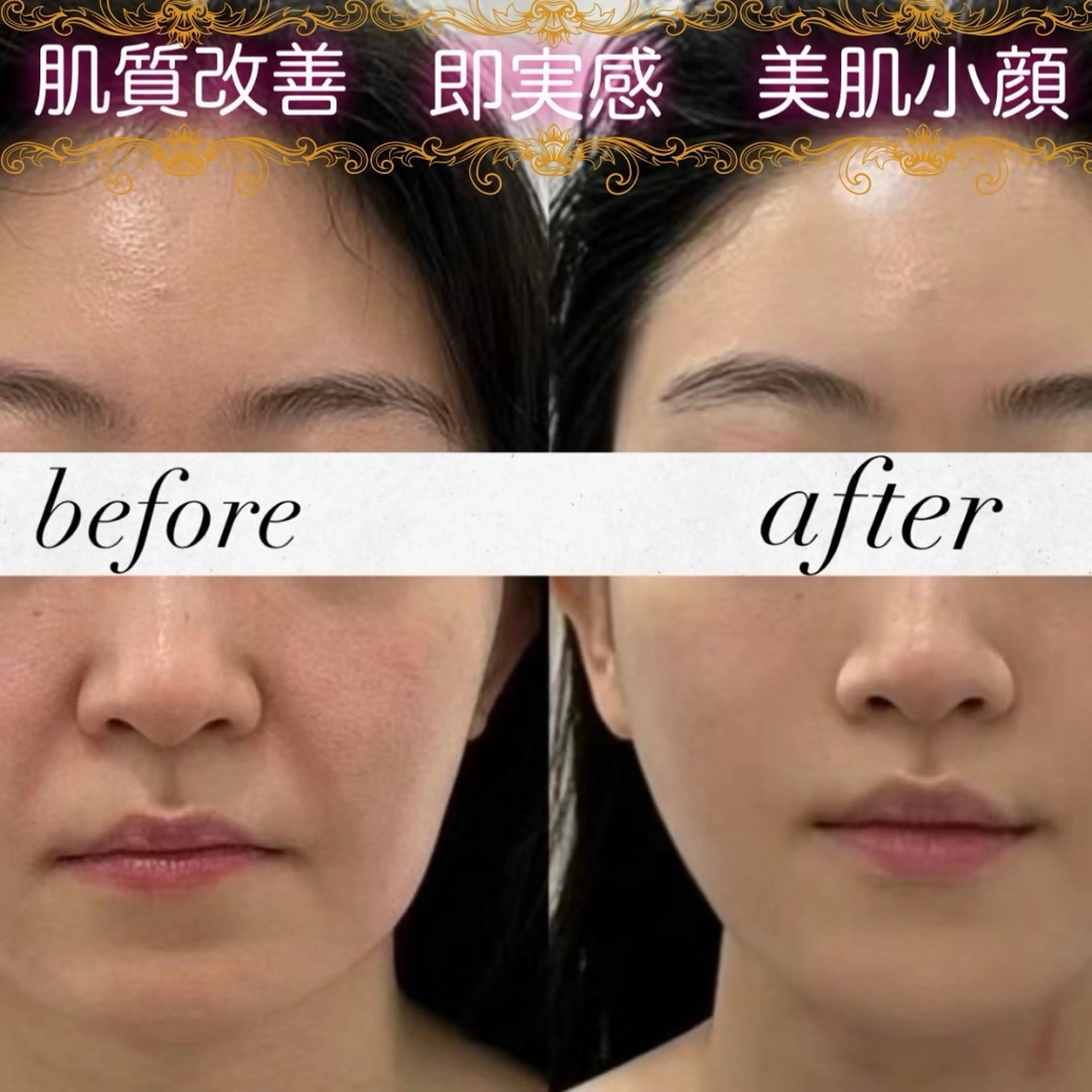 ネイル エステ aliaハイフ&水光ジェットサロン所属・aliaハーブ水光店 エステティシャン募集のエステ・リラクイメージ