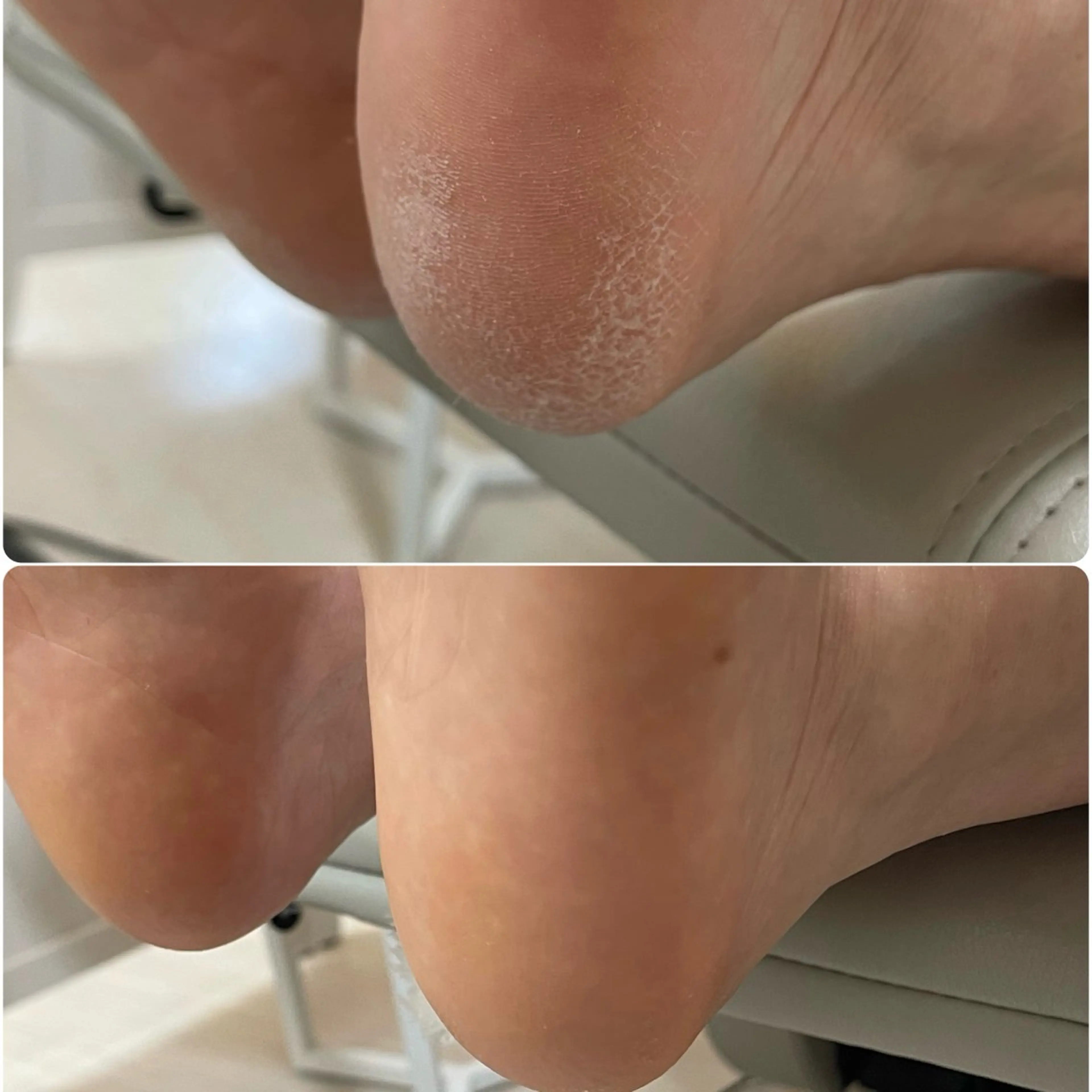 【乾燥撃退!足元お手入れ】Foot＊つるつる足裏角質ケアの写真