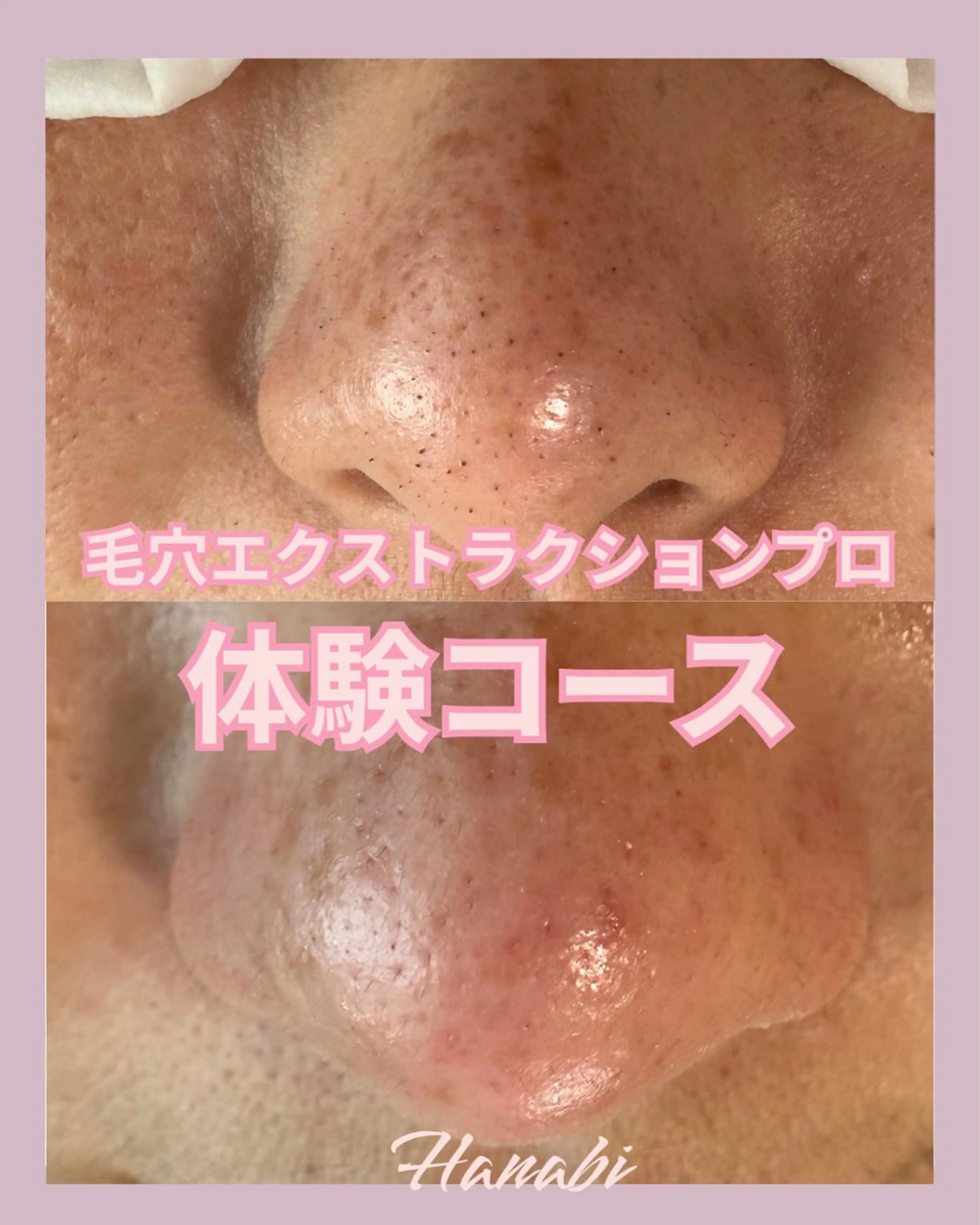 エステ 毛穴専門サロン Hanabiのエステ・リラクイメージ