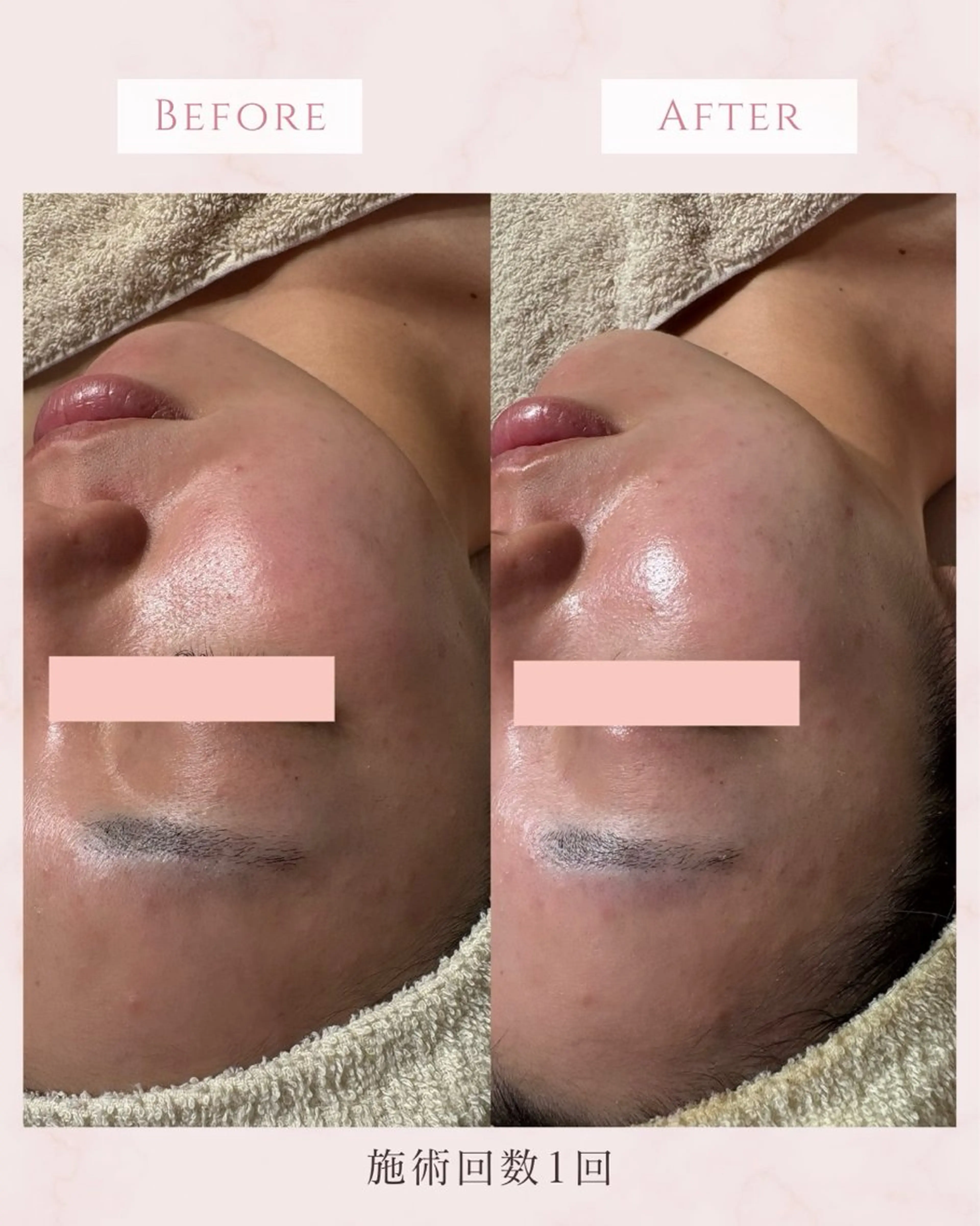 エステ Ricerca ビューティーサロンのエステ・リラクイメージ