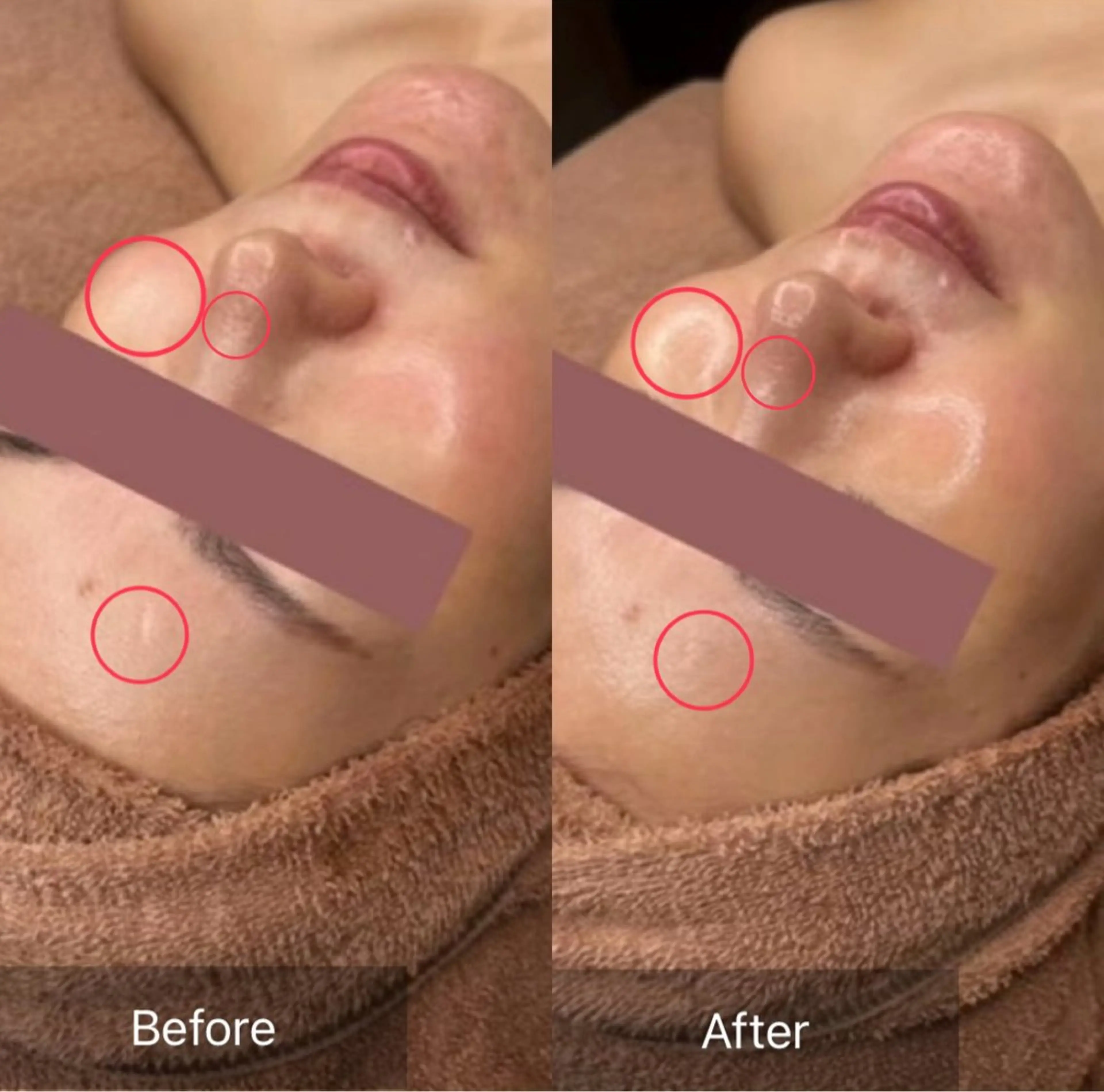 エステ リラク 💎ボディエステ＆ 脱毛＆スパ💎山岡のエステ・リラクイメージ