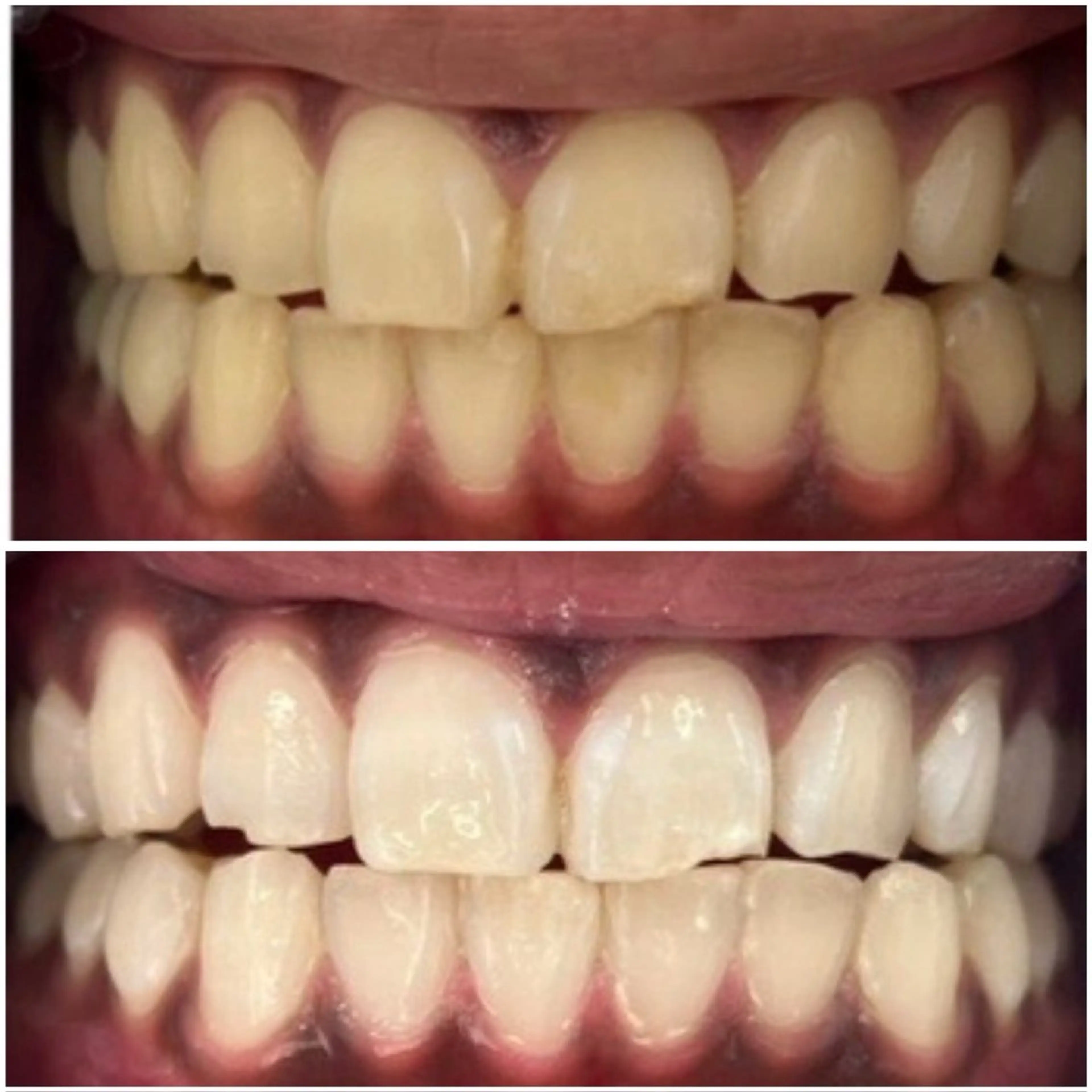 エステ セルフホワイトニングサロンエクシアホワイト倉敷店所属・ecxiawhite 倉敷店のエステ・リラクイメージ