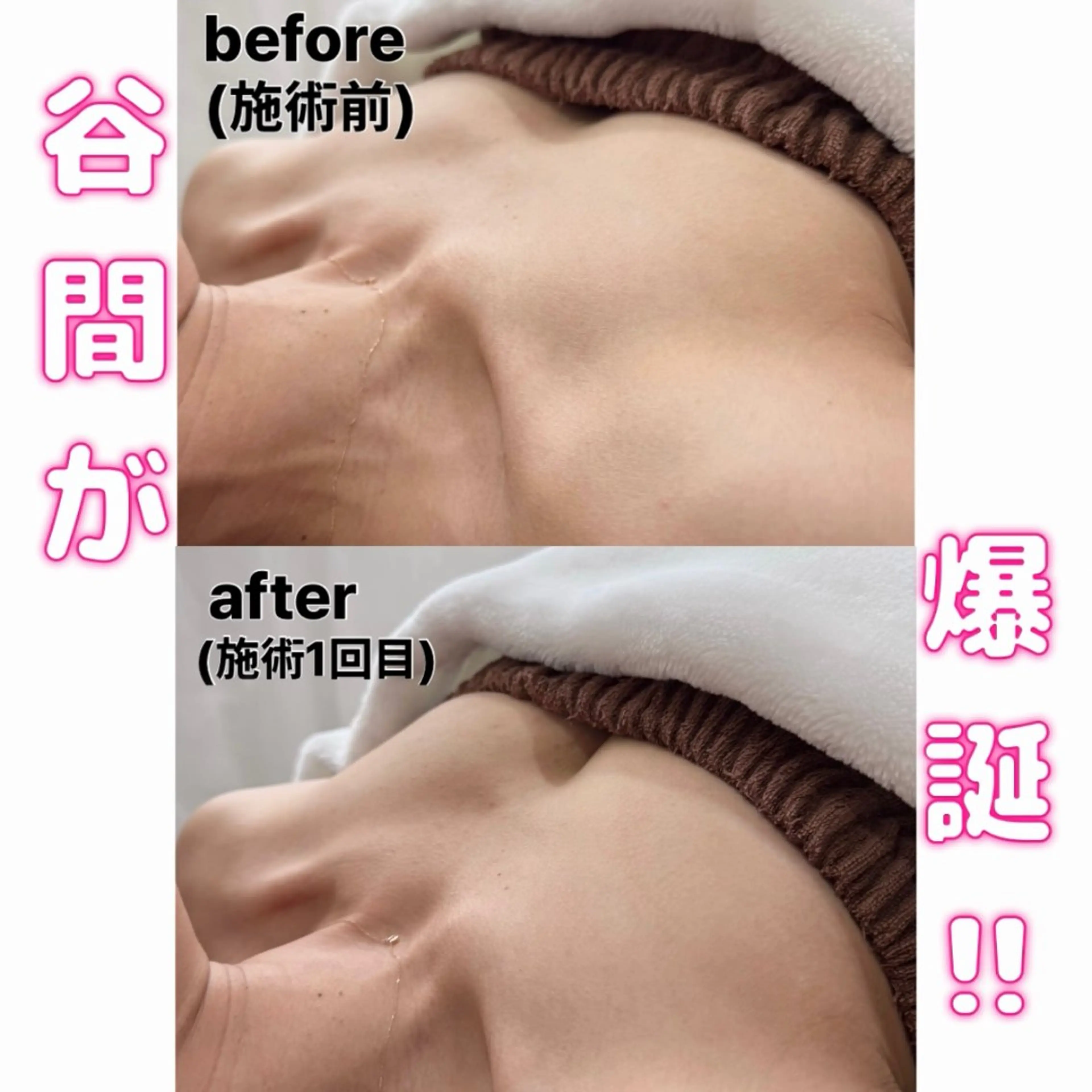 バストケアの写真