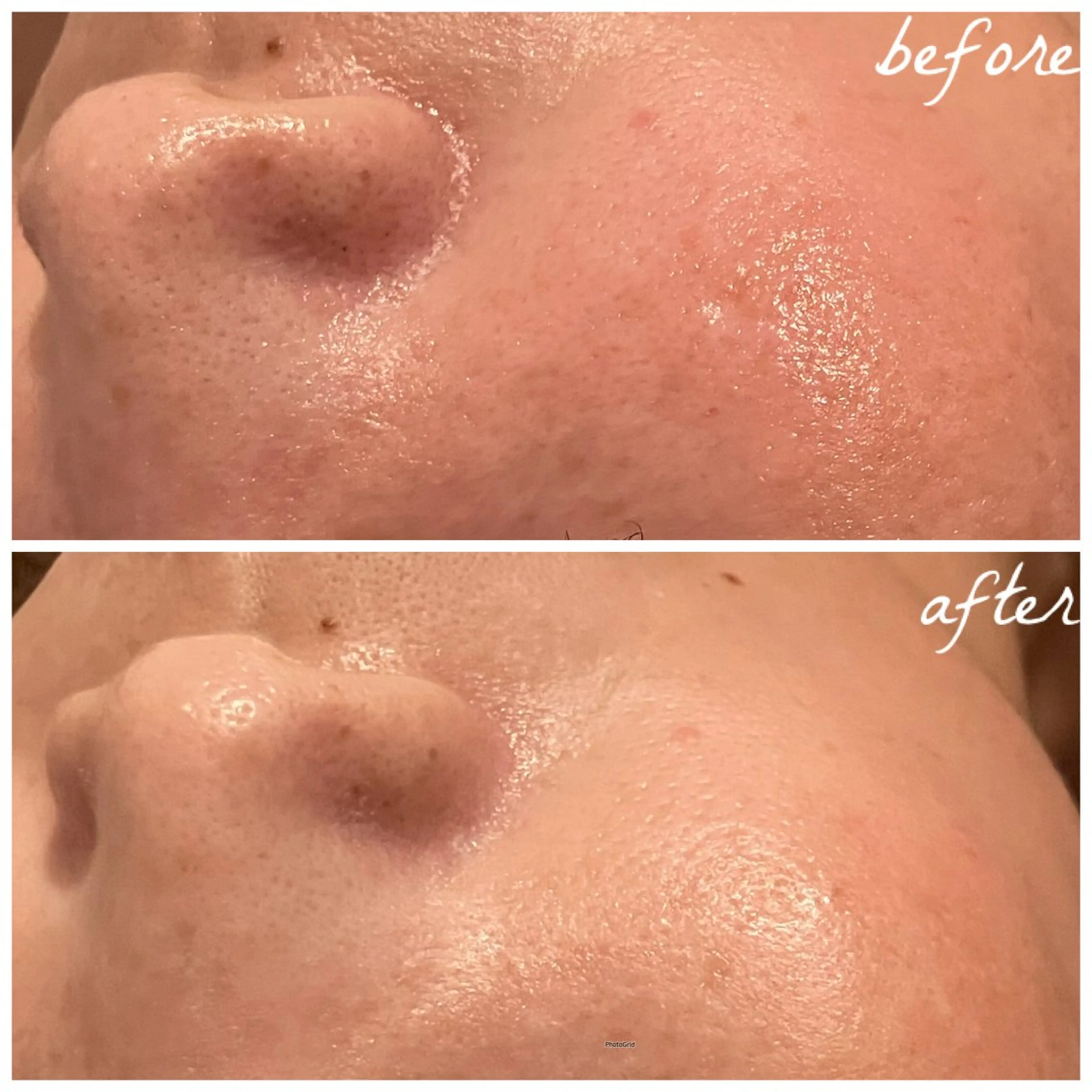 メンズ エステ メナード岐阜茜部 杉浦のエステ・リラクイメージ