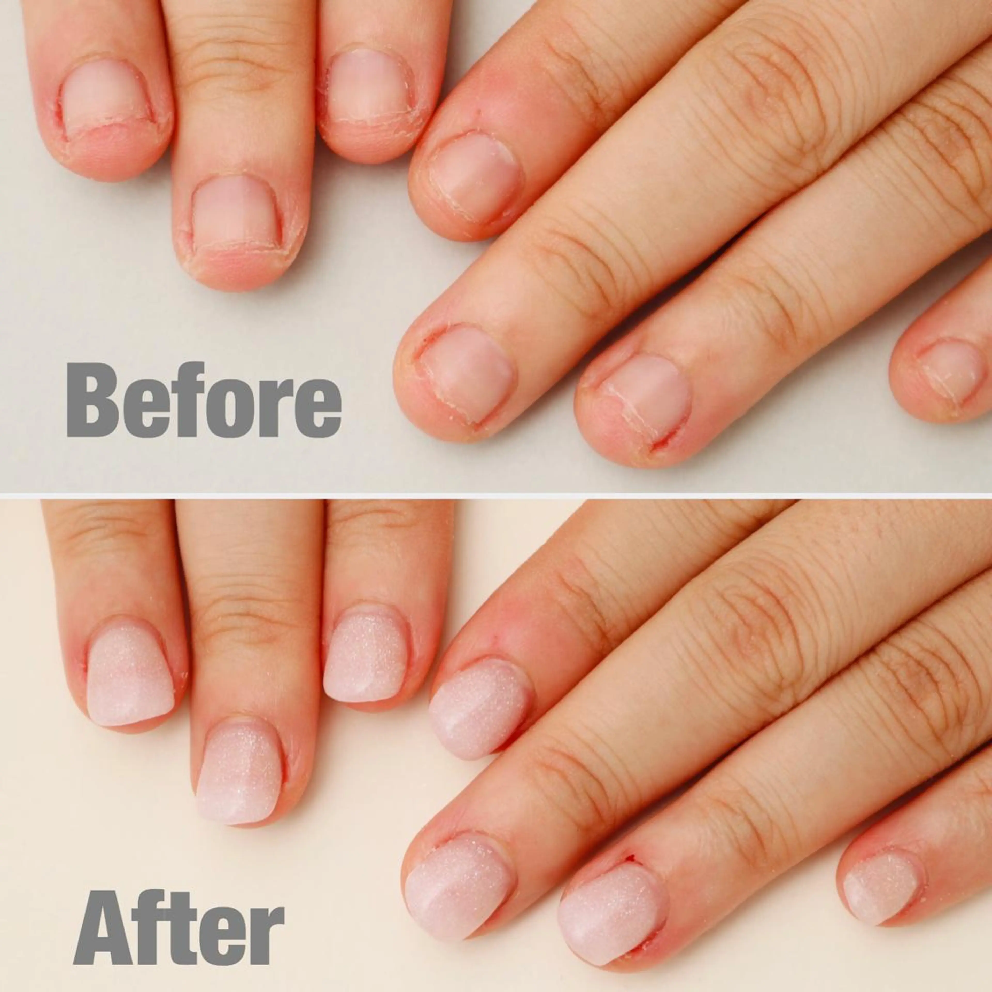 深爪矯正長さだし 1カラーorグラデーション☆色を楽しみながら矯正☆ ※ハンドのみの写真