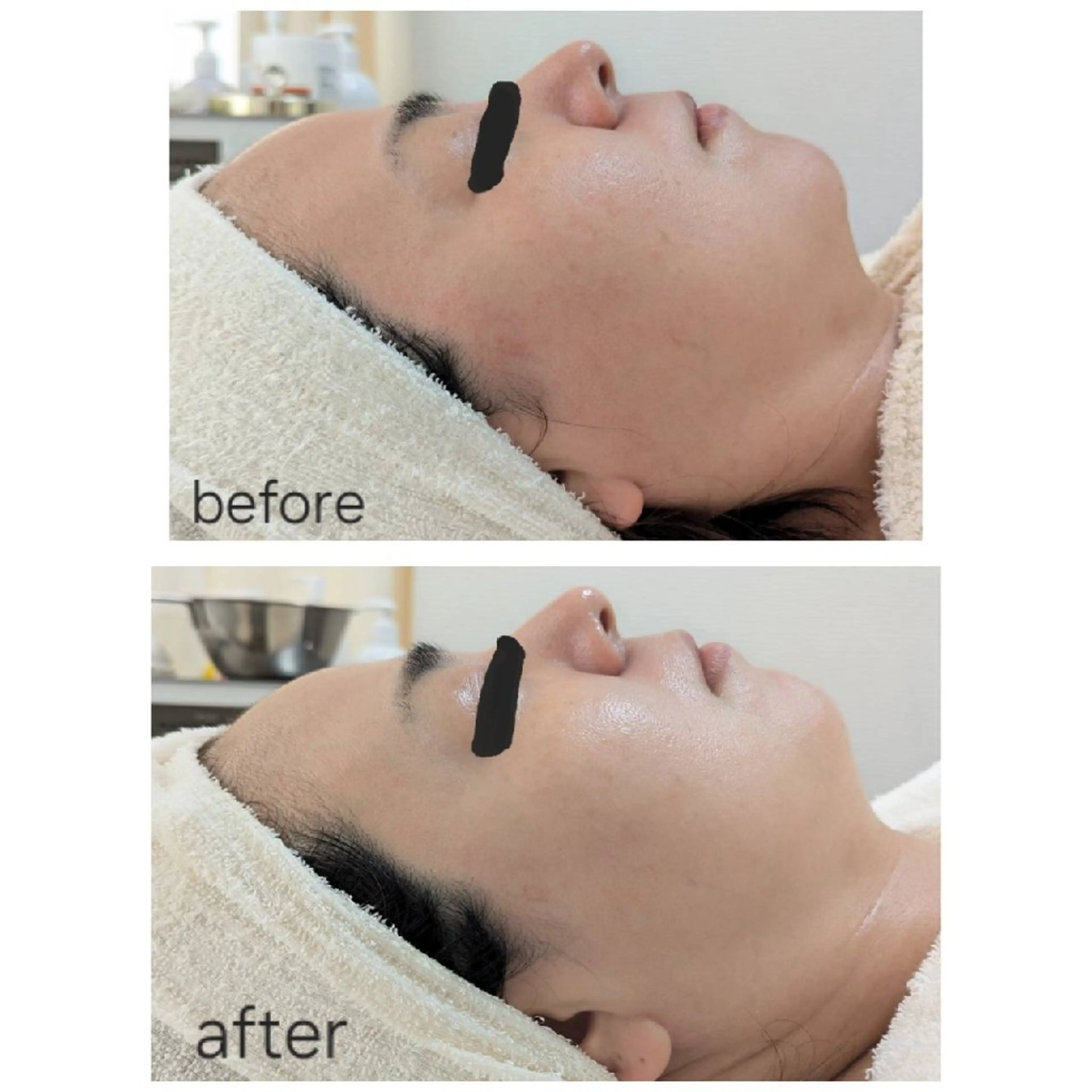 ニキビ・ニキビ跡専門 レゾン京橋店　のエステ・リラクイメージ