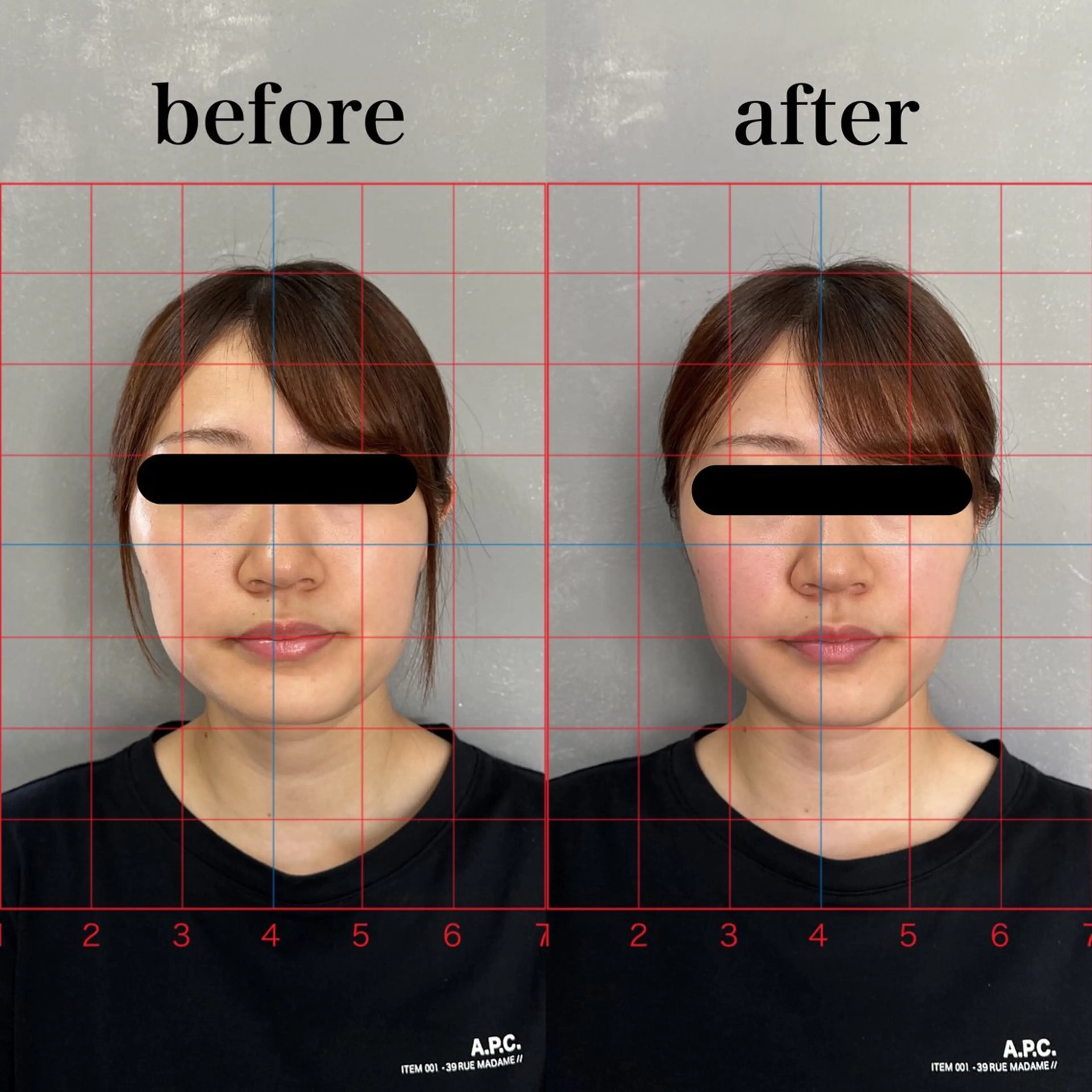 鍼灸整体専門サロン 島袋のエステ・リラクイメージ