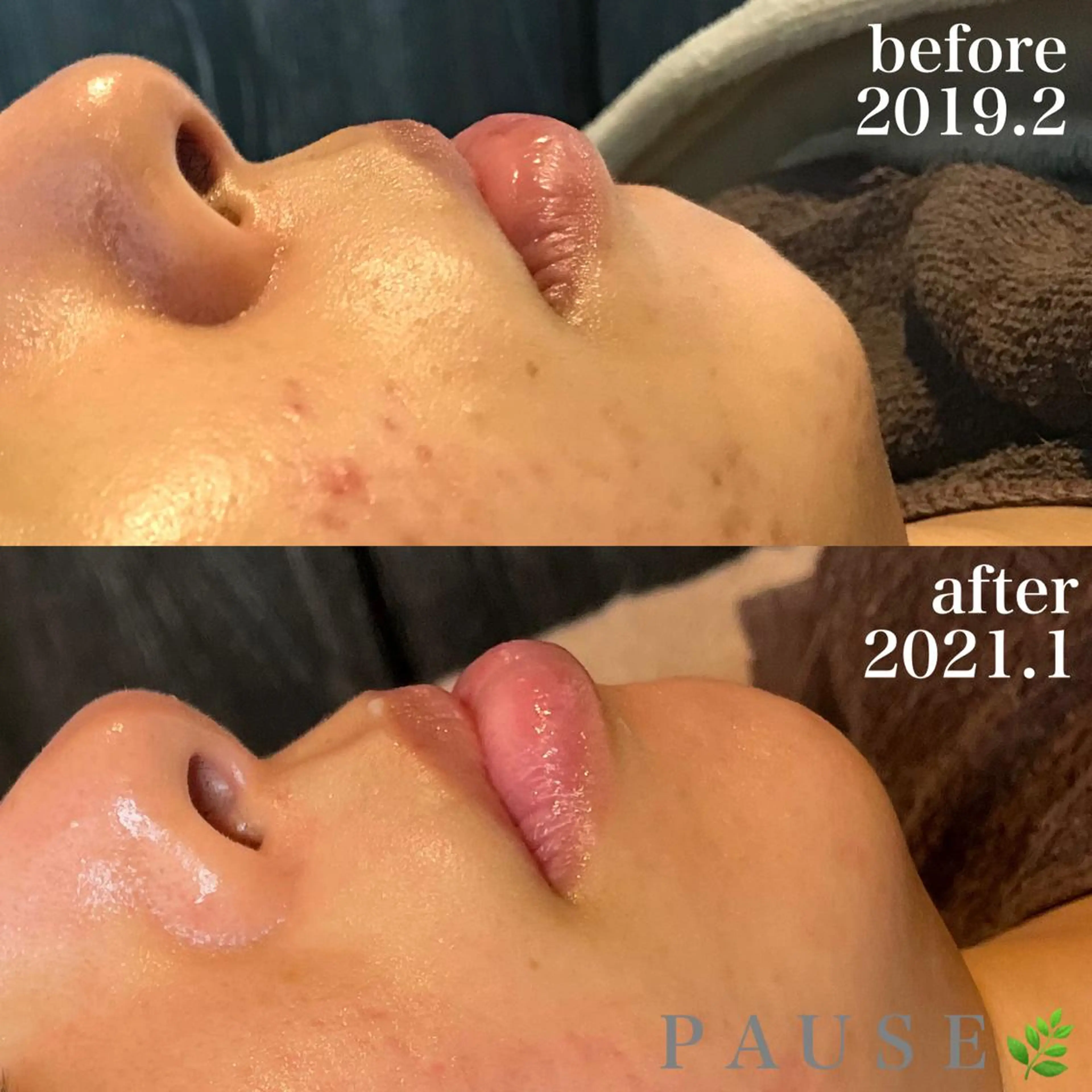 エステ 浜野 恵美のエステ・リラクイメージ