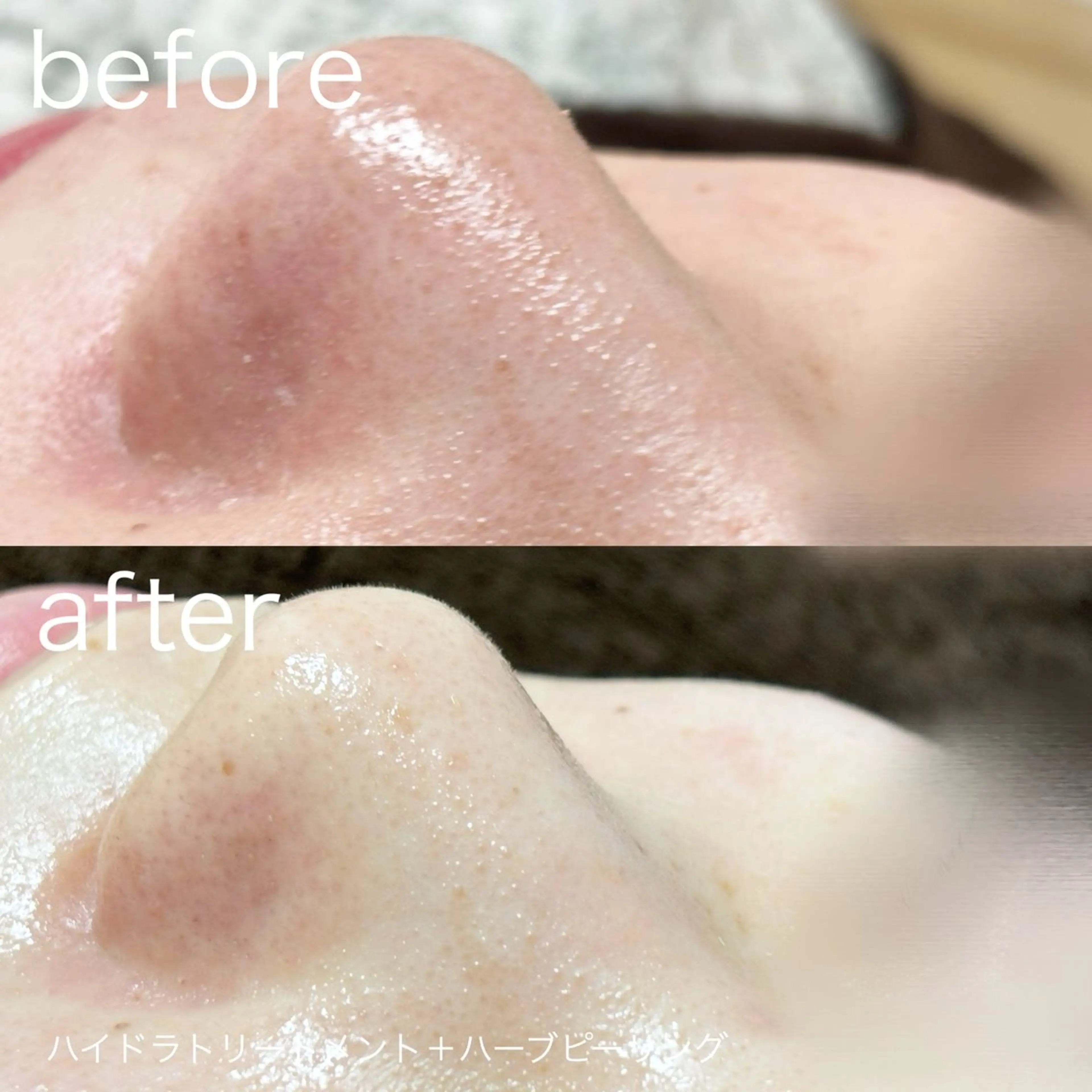 その他 lulularico Yuのエステ・リラクイメージ