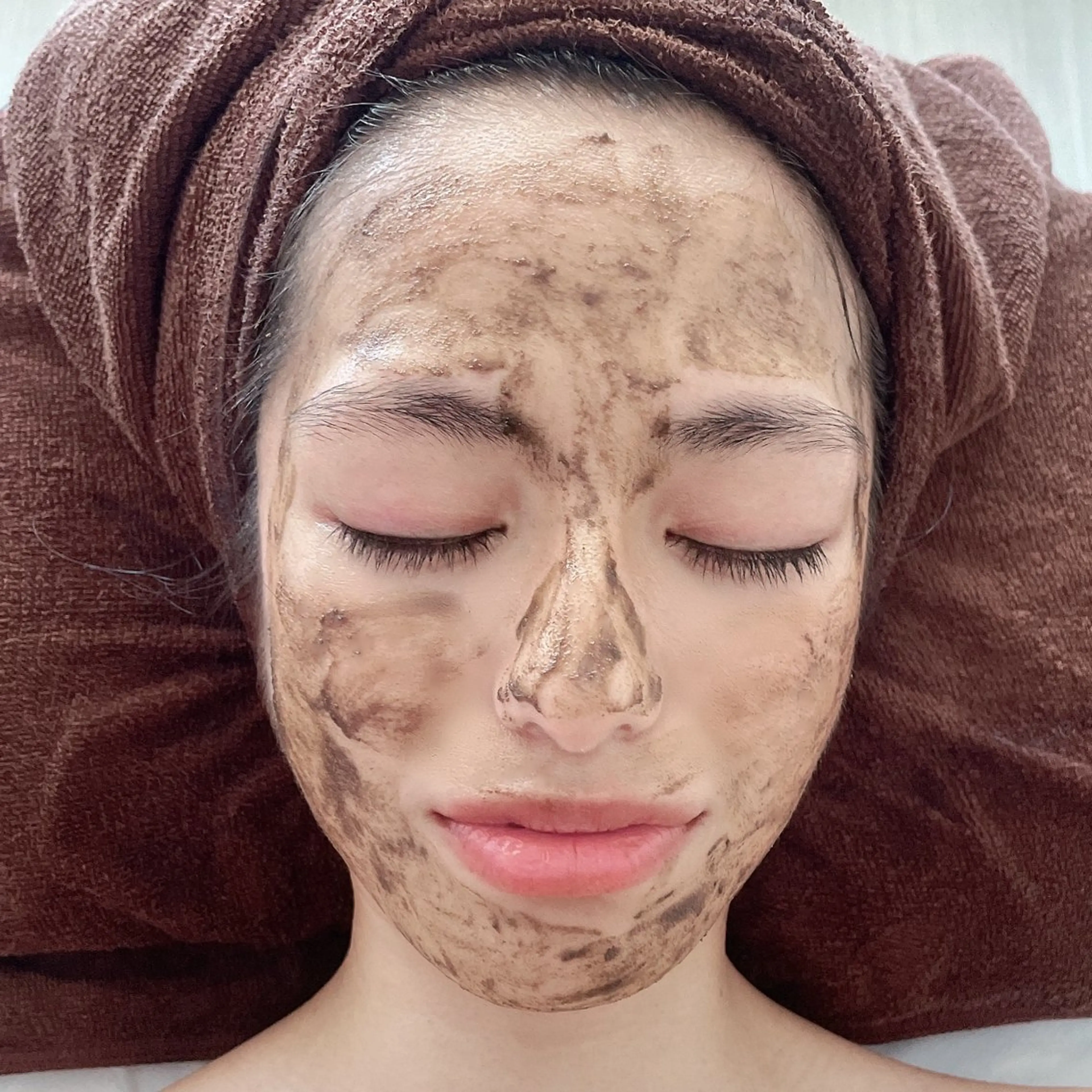 剥離なしハーブピーリング🌿1部位の写真