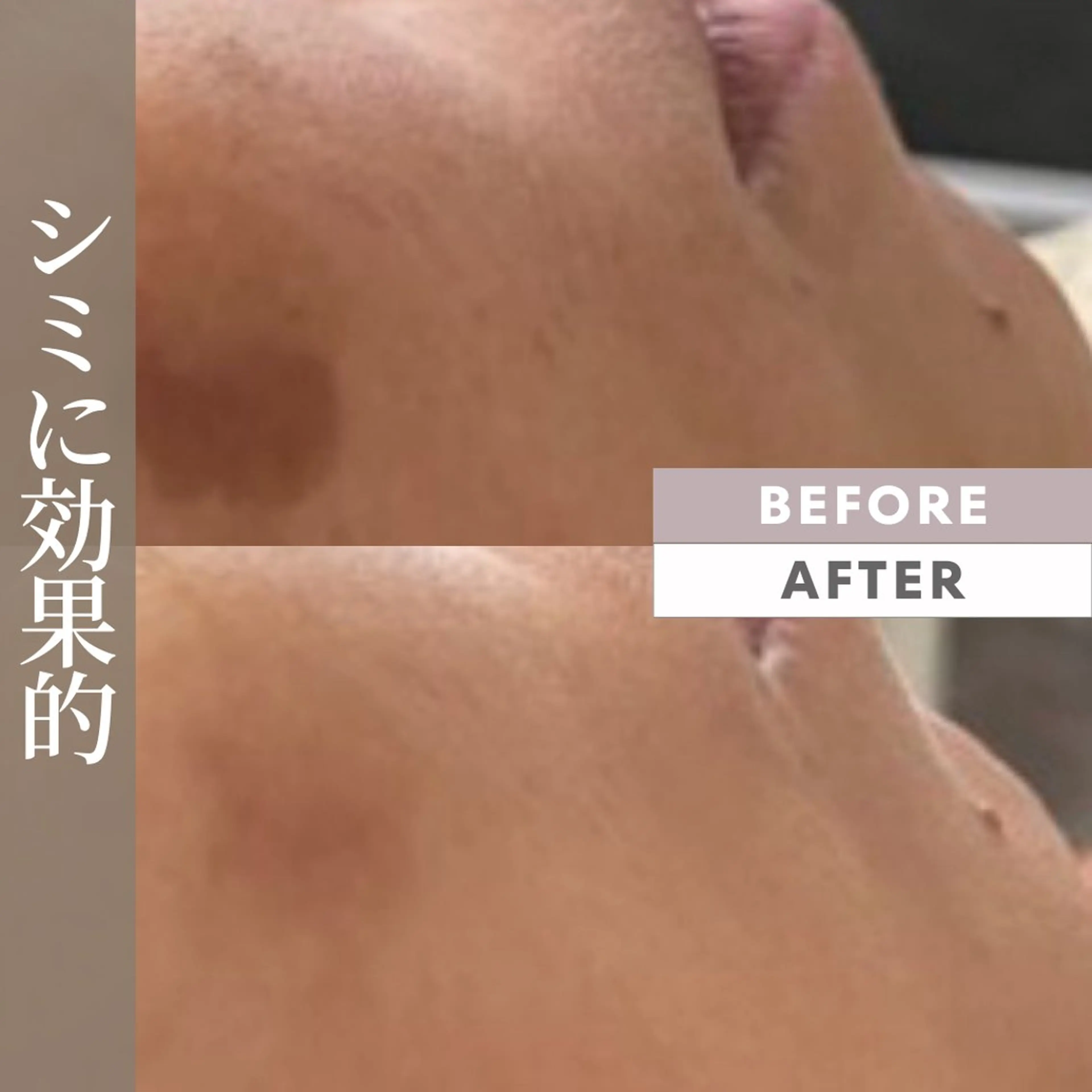 メンズ 井上 みあのエステ・リラクイメージ