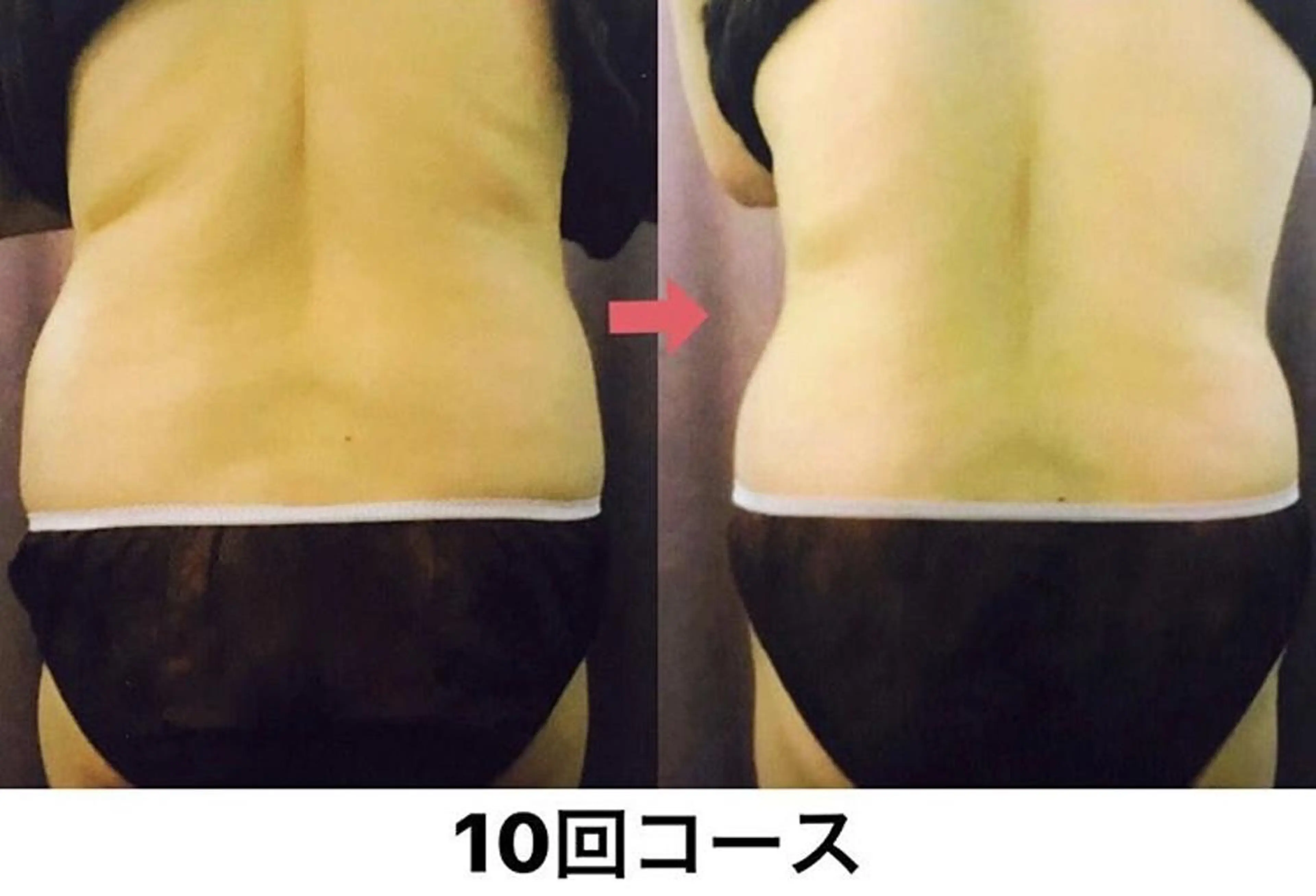 横浜エステサロン R-ing　リングのエステ・リラクイメージ