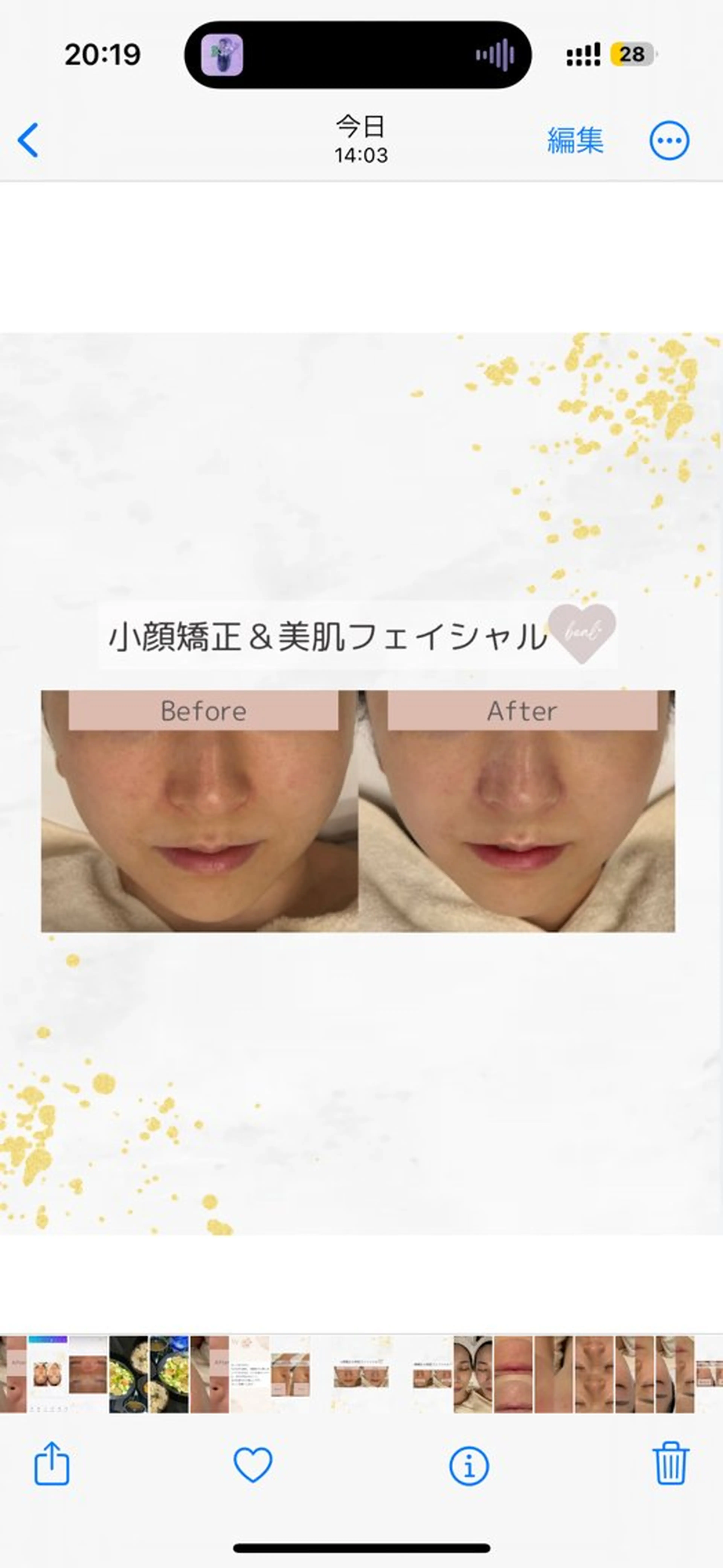 小顔/毛穴/ニキビ salon bealのエステ・リラクイメージ