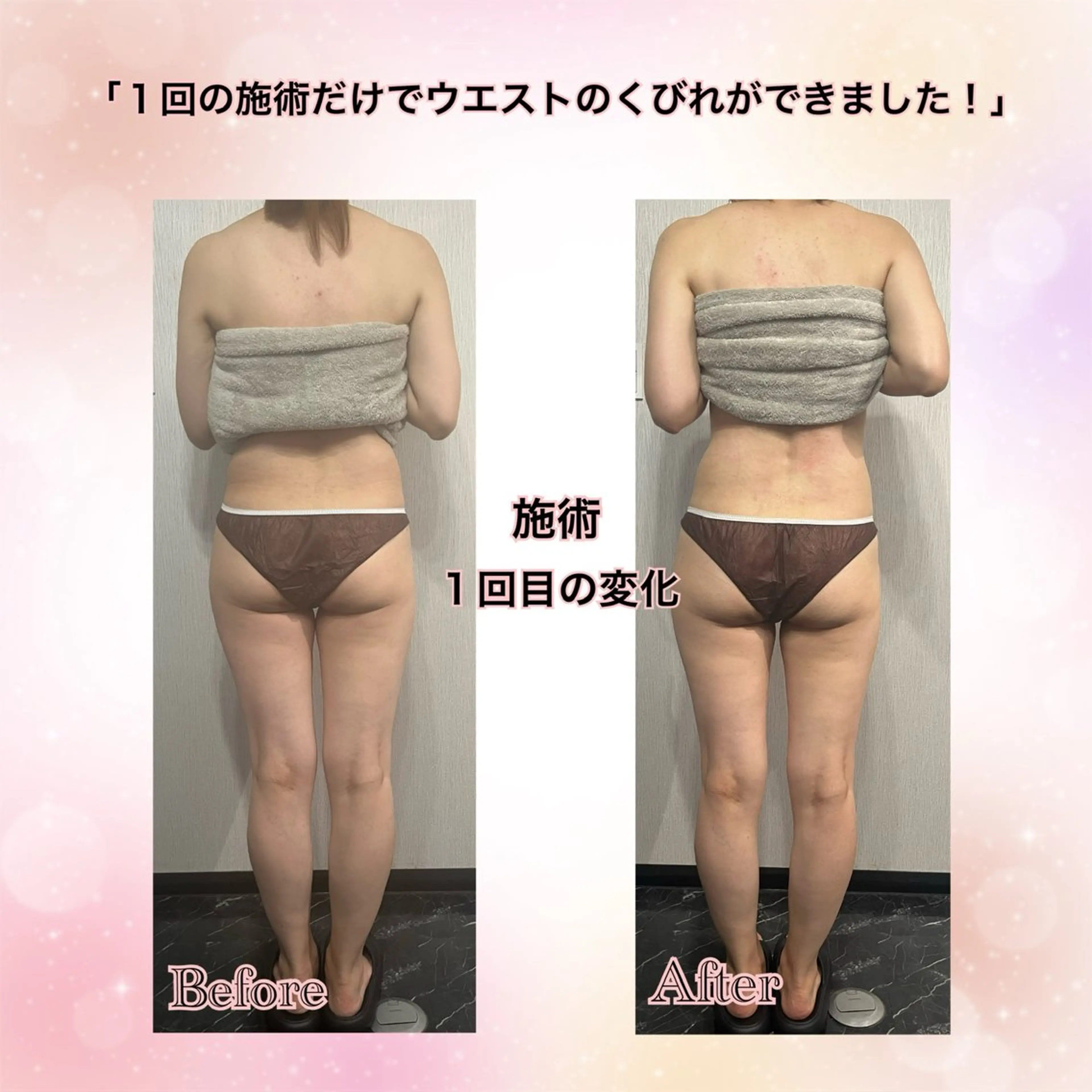 全身アロママッサージの写真