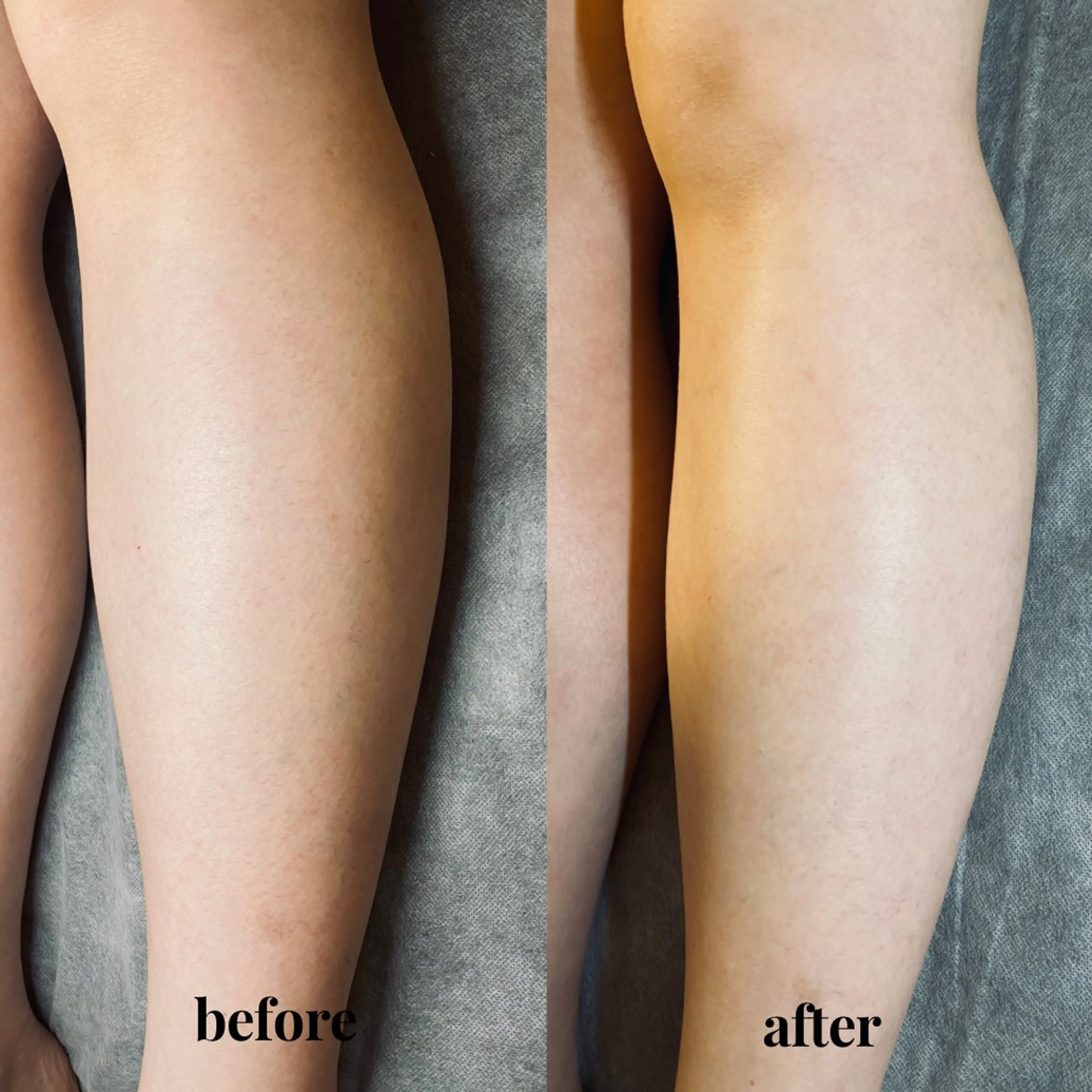 シュガーリング 【MARLS】のエステ・リラクイメージ