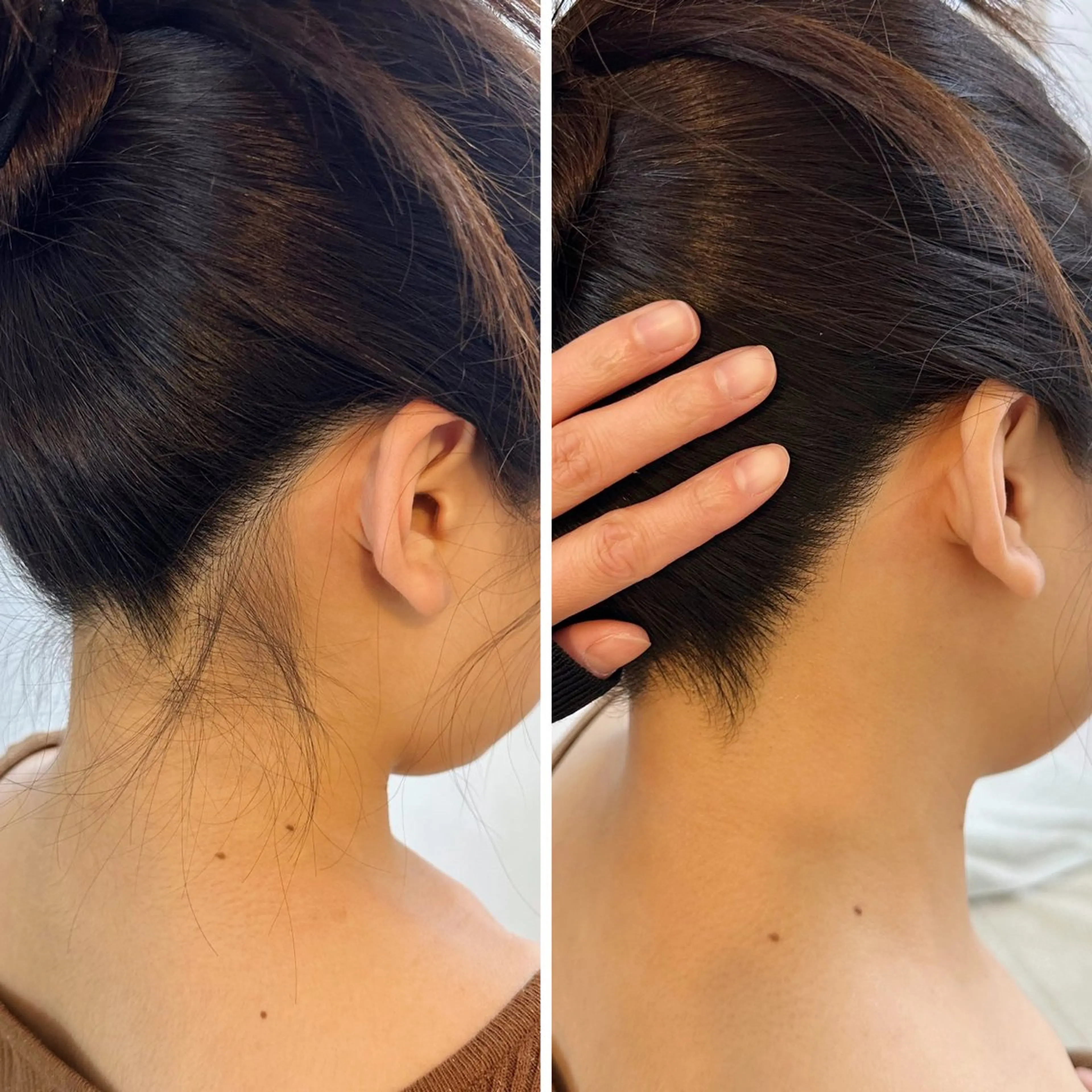 脱毛 うなじ脱毛/美肌脱毛 LABELのエステ・リラクイメージ