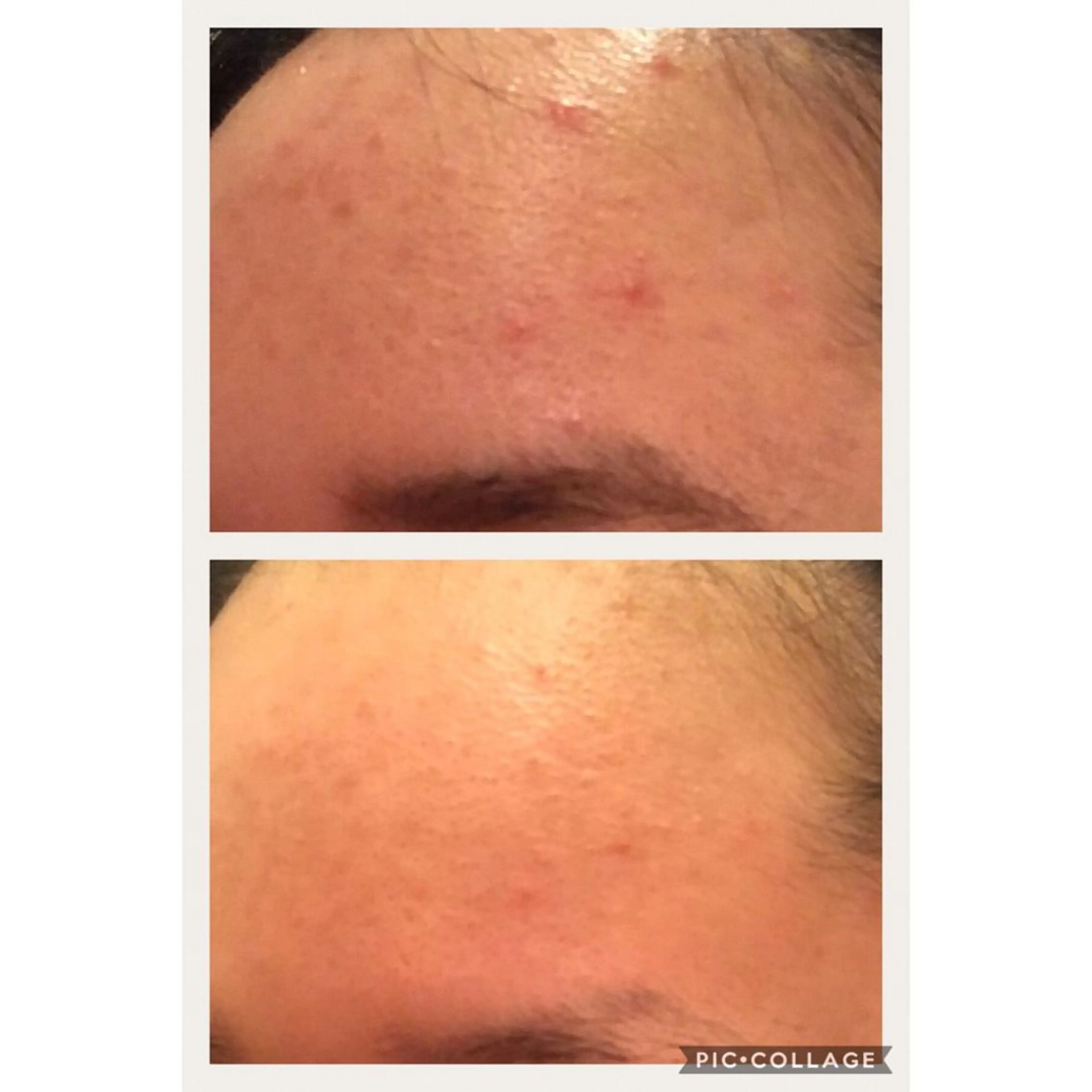 ミディアム エステ リラク ニキビ跡専門サロン Ａｉｎａのエステ・リラクイメージ