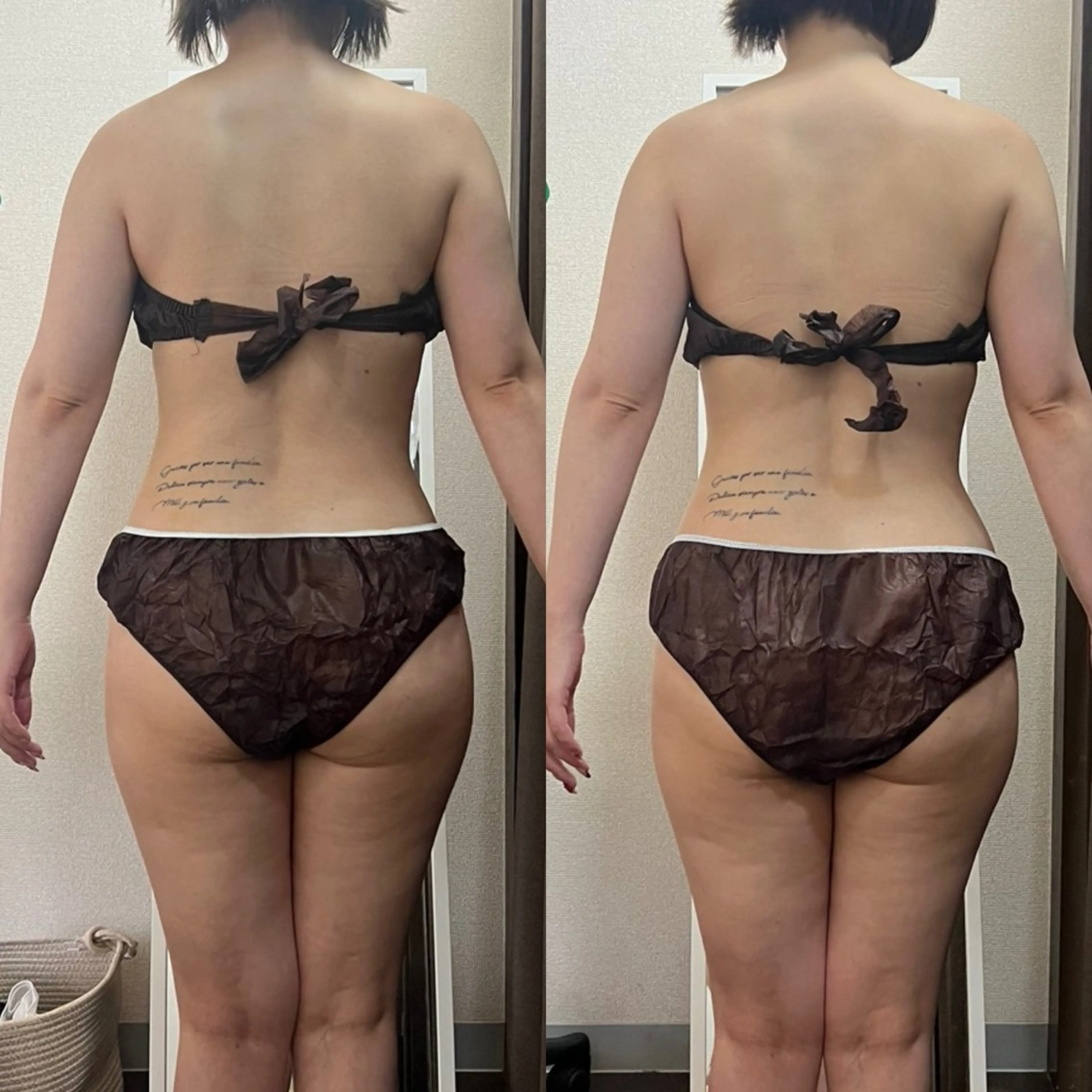 ハイパーナイフ専門店　Salon de COCO所属・Salon de COCOのエステ・リラクイメージ