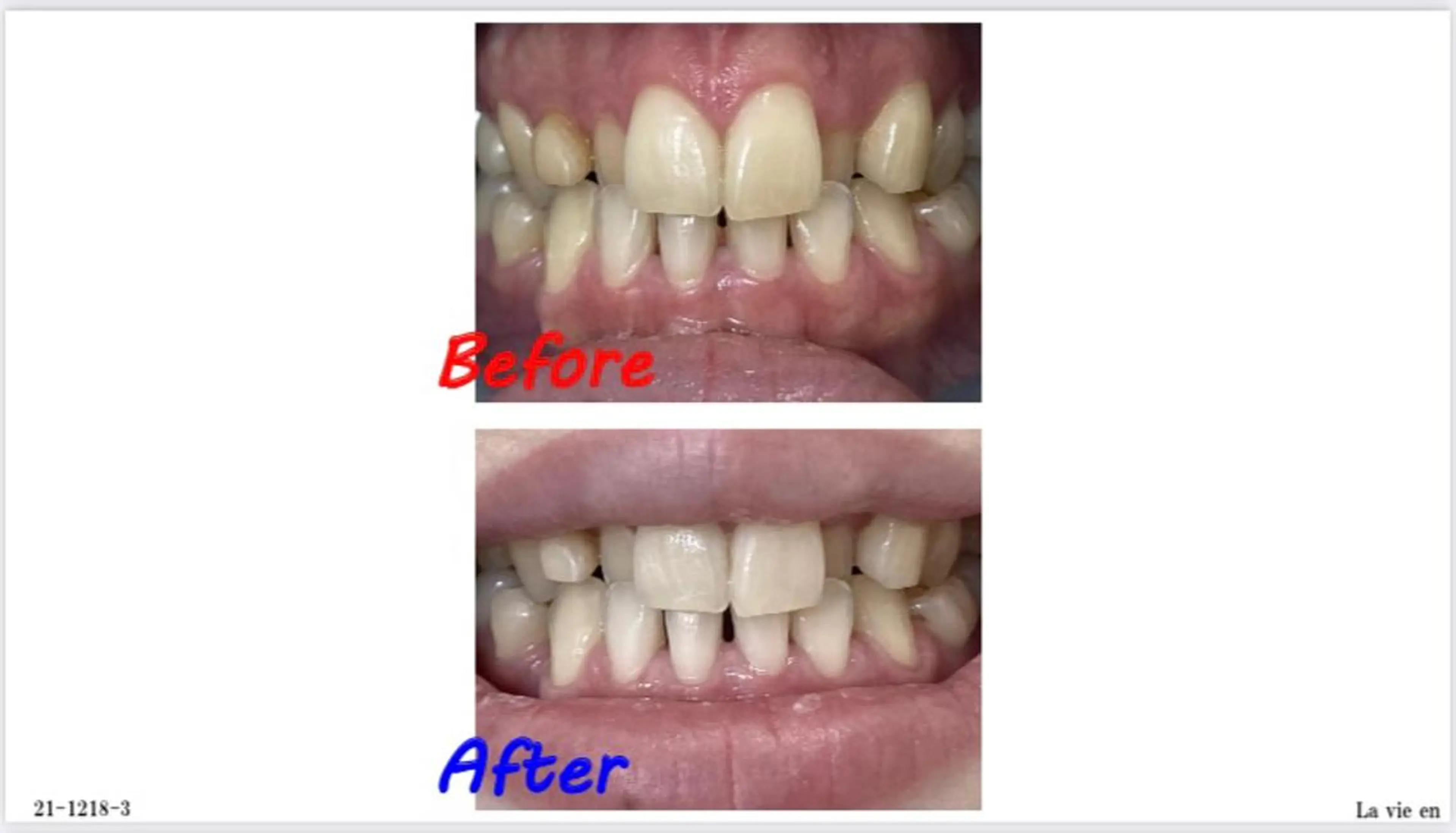 その他 セルフホワイトニングサロン　ラヴィアン所属・ホワイトニングサロン La vie enのその他イメージ