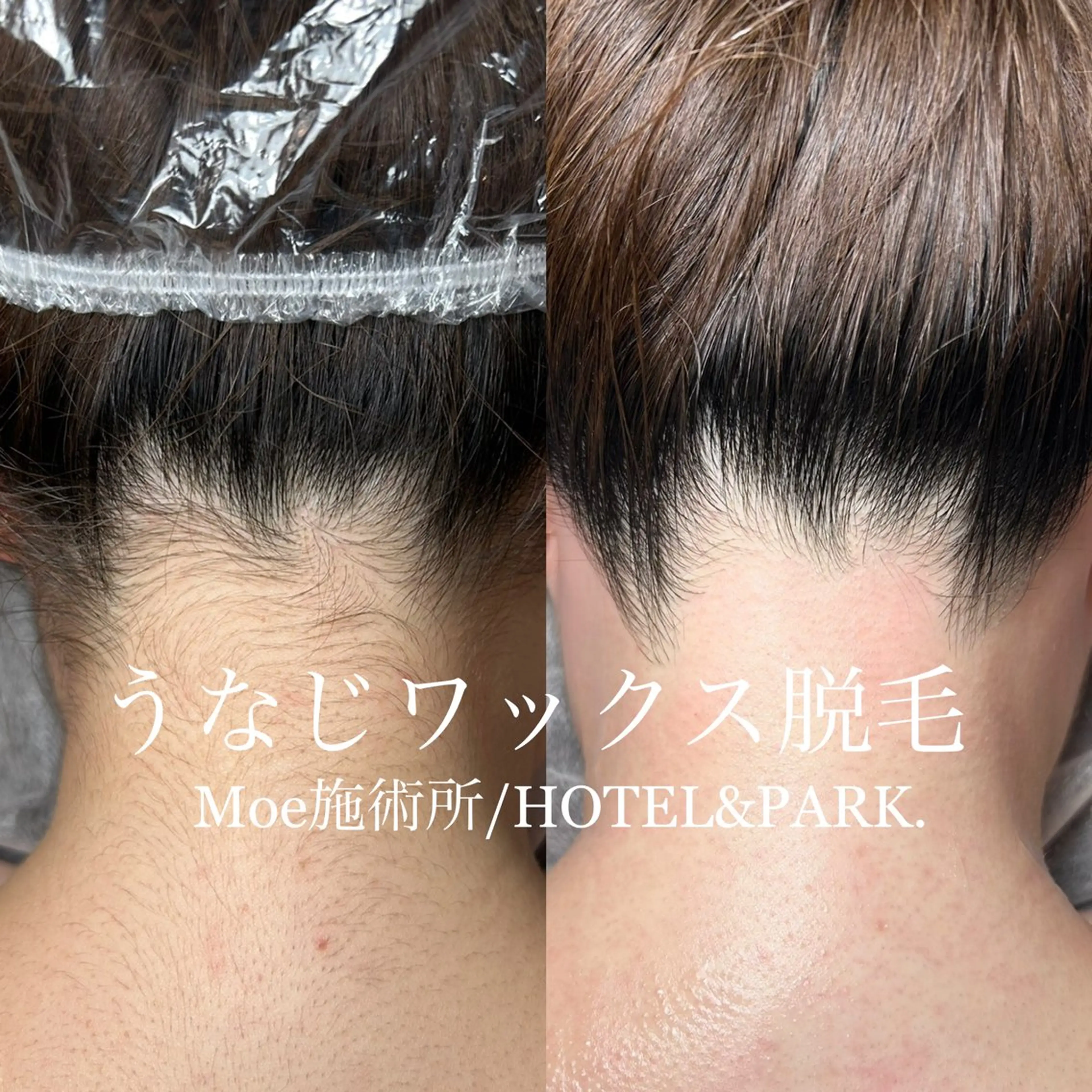 HOTEL&PARK .Moeワックス脱毛のエステ・リラクイメージ