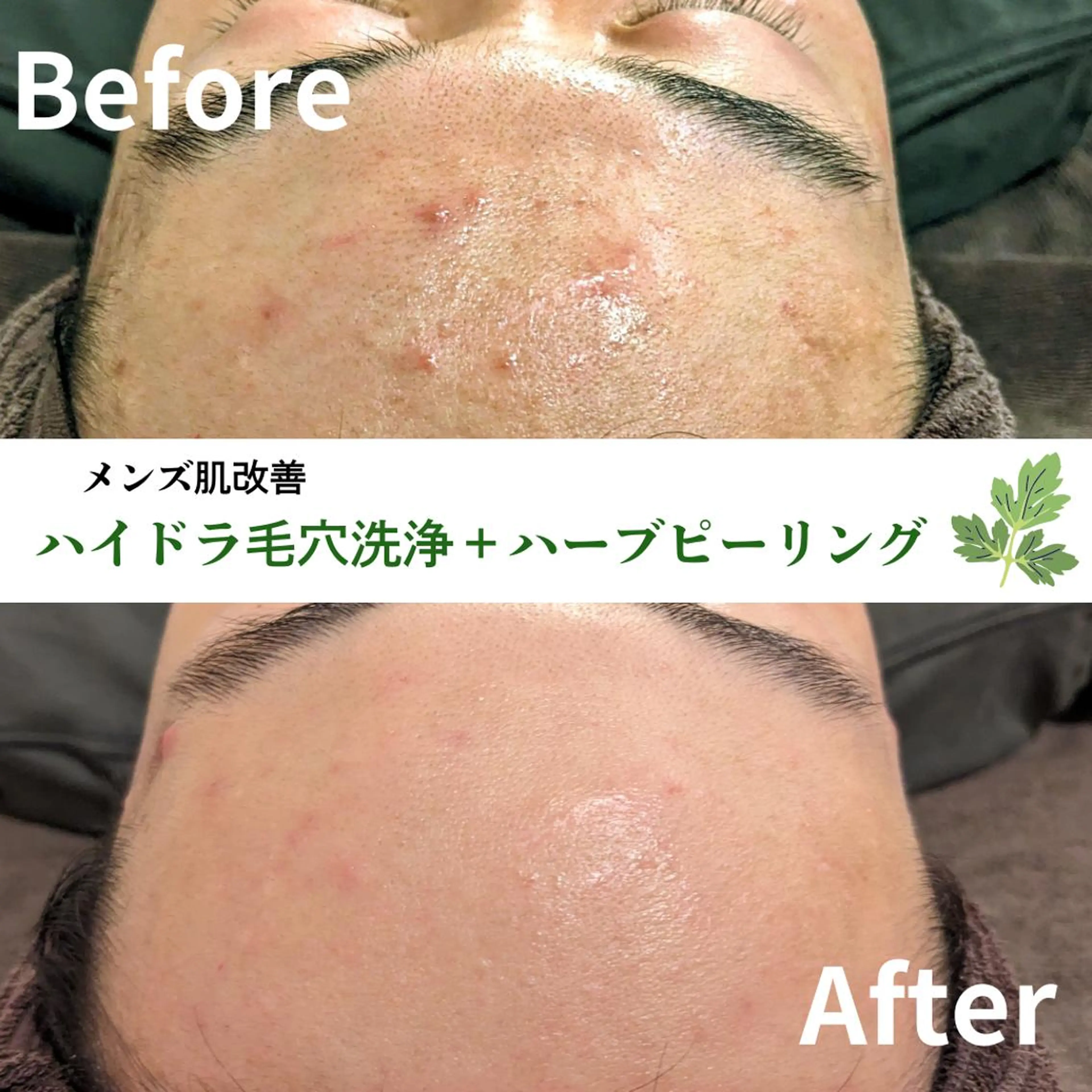 小顔矯正コルギ専門 ボディーワークスナビのエステ・リラクイメージ