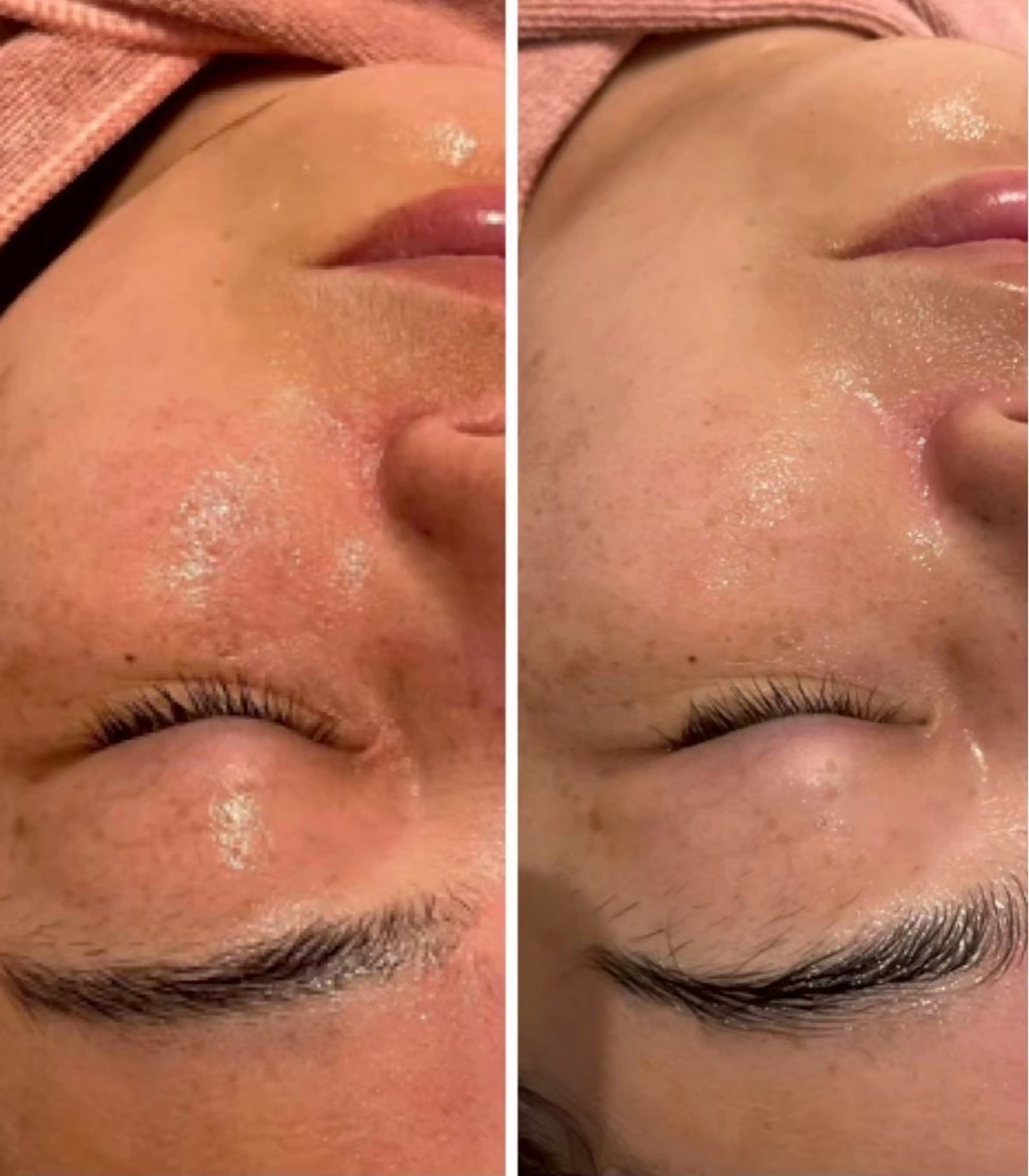 エステ エムフルール リラク＆エステのエステ・リラクイメージ