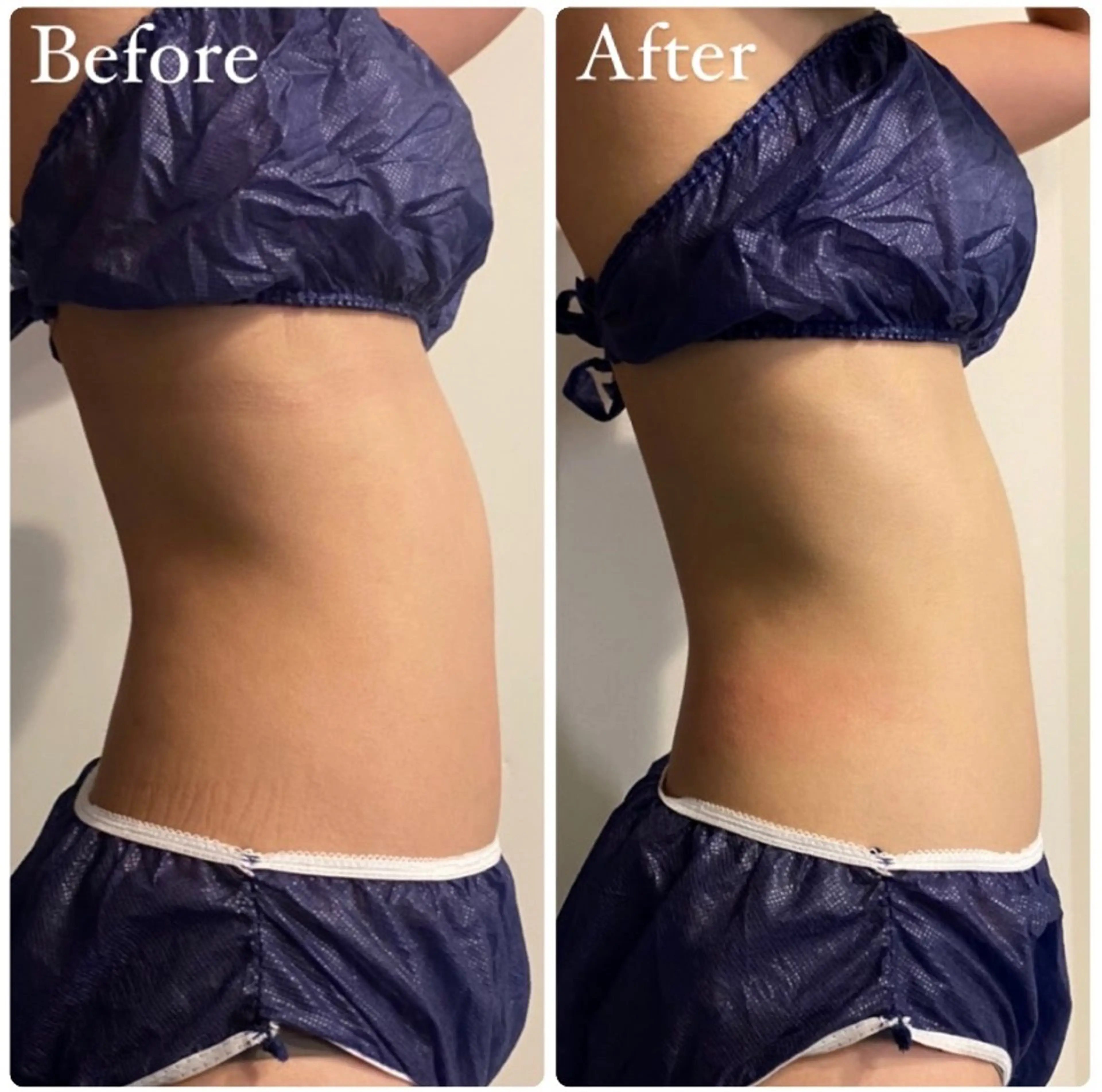 エステ beautysalon RAVIS所属・東大阪/韓国肌管理/ 痩身バスト専門店のエステ・リラクイメージ