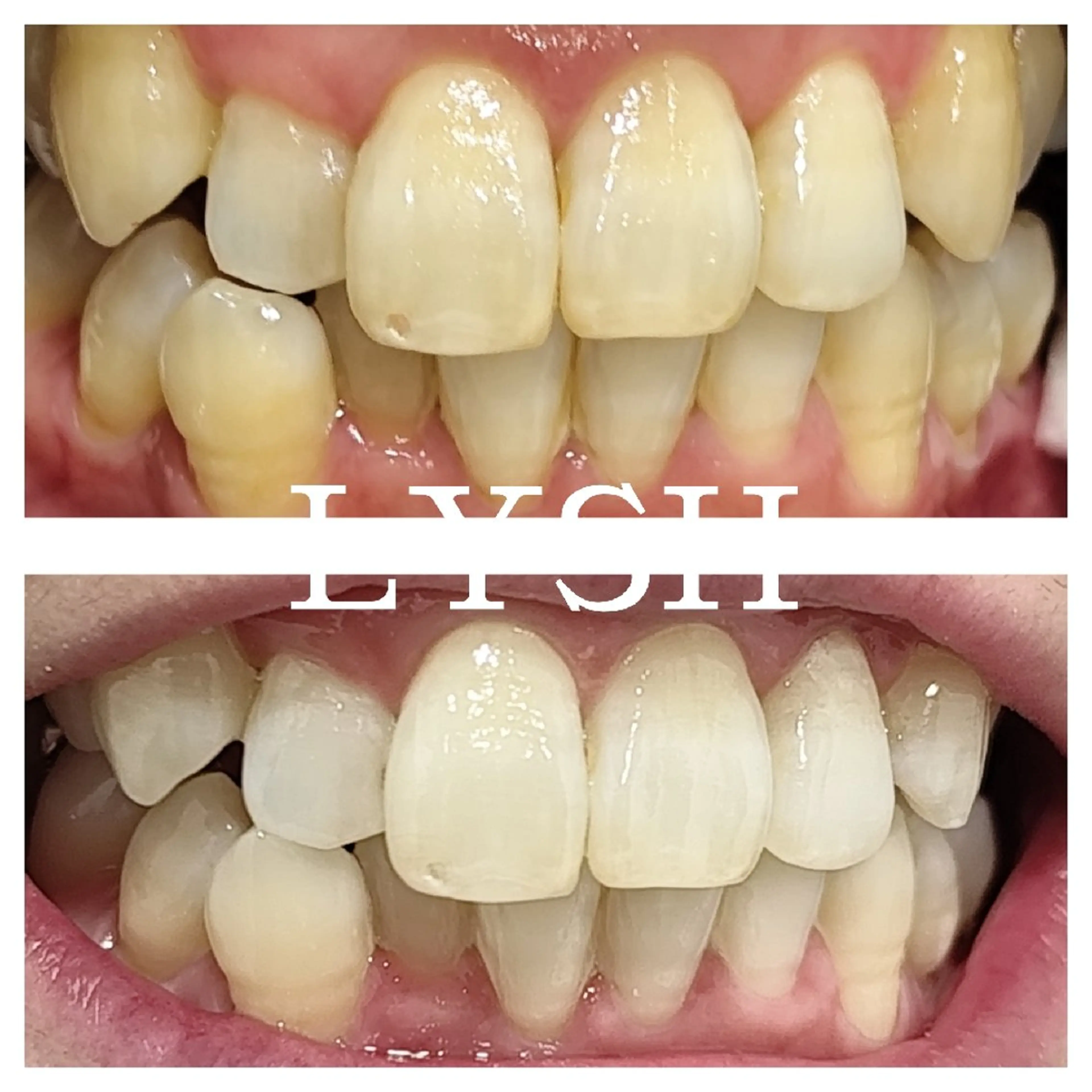 エステサロン LYSHのその他イメージ