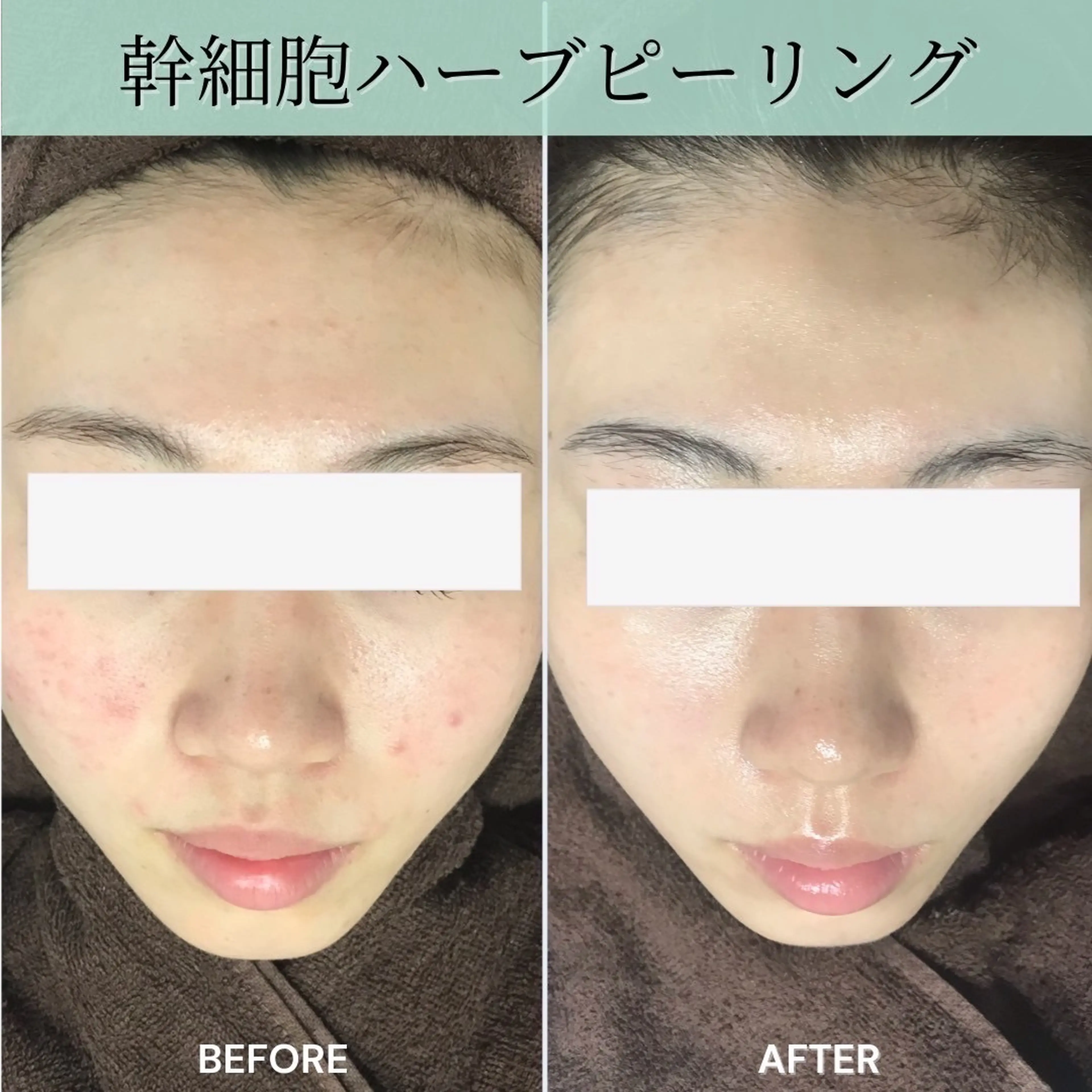 ヒト幹細胞サロン SkinBaby　新越谷店の内観・外観2