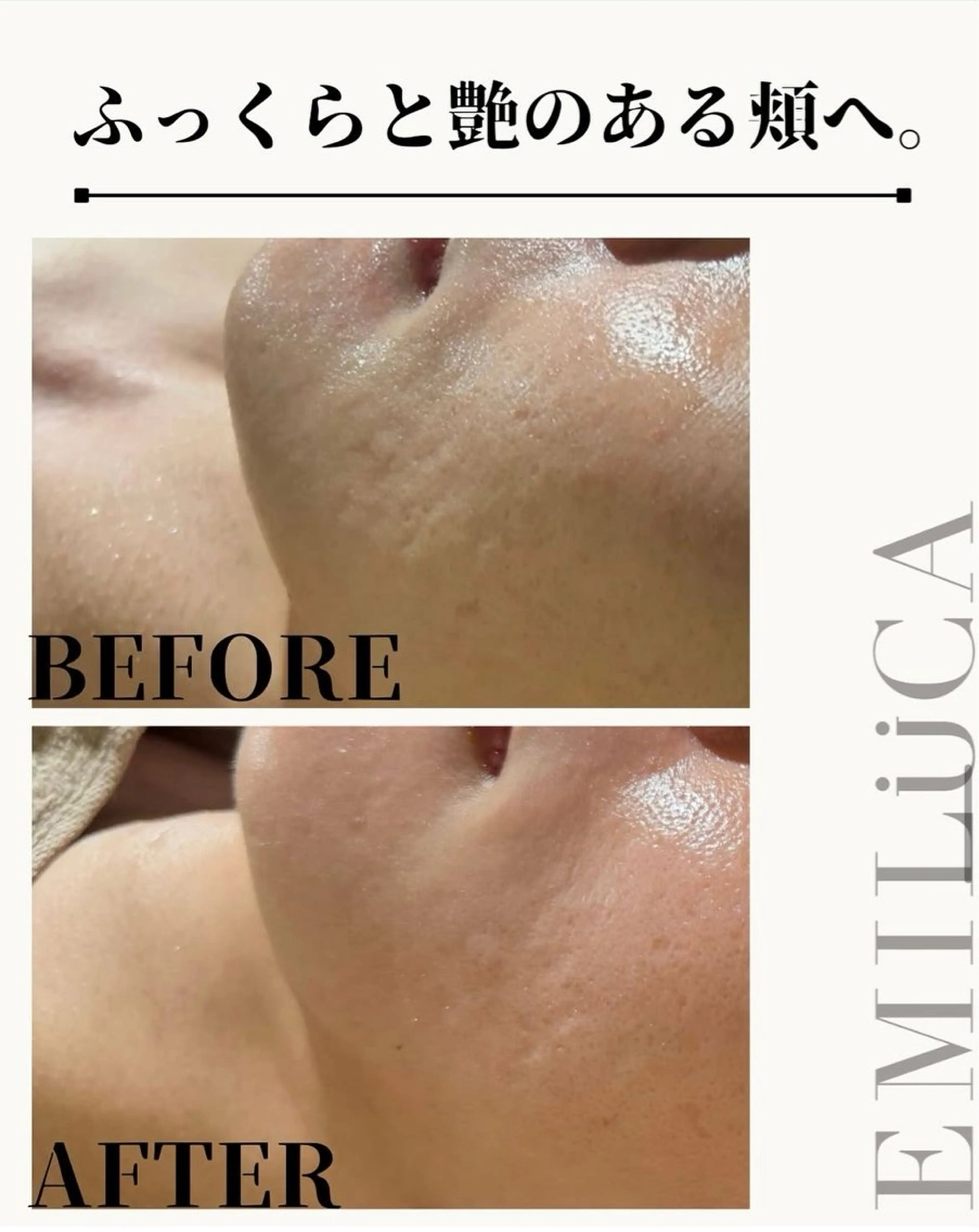 エミルカ　自由が丘店所属・花島 悠のエステ・リラクイメージ