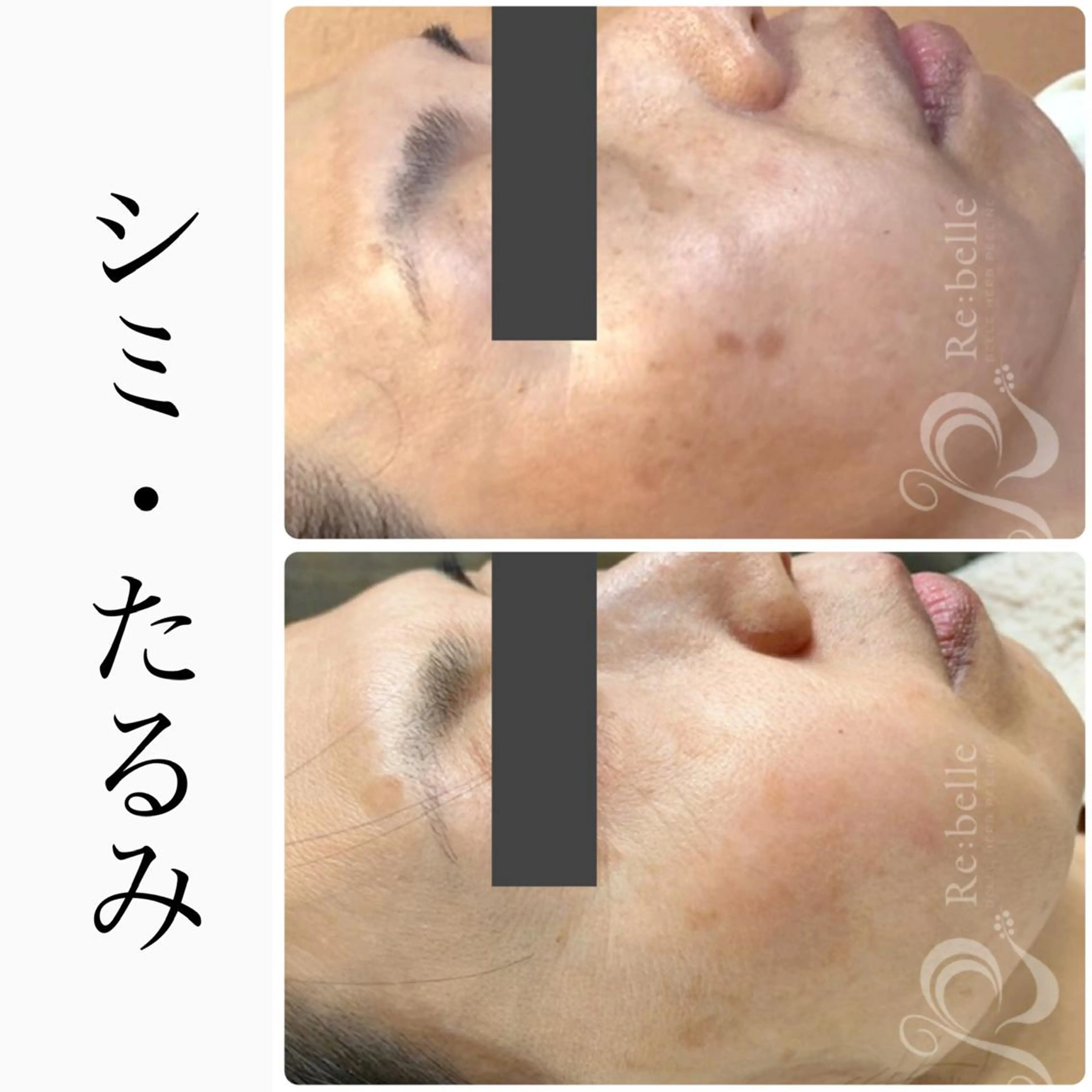 エステ ハーブピーリング専門 BIOEL横浜のエステ・リラクイメージ