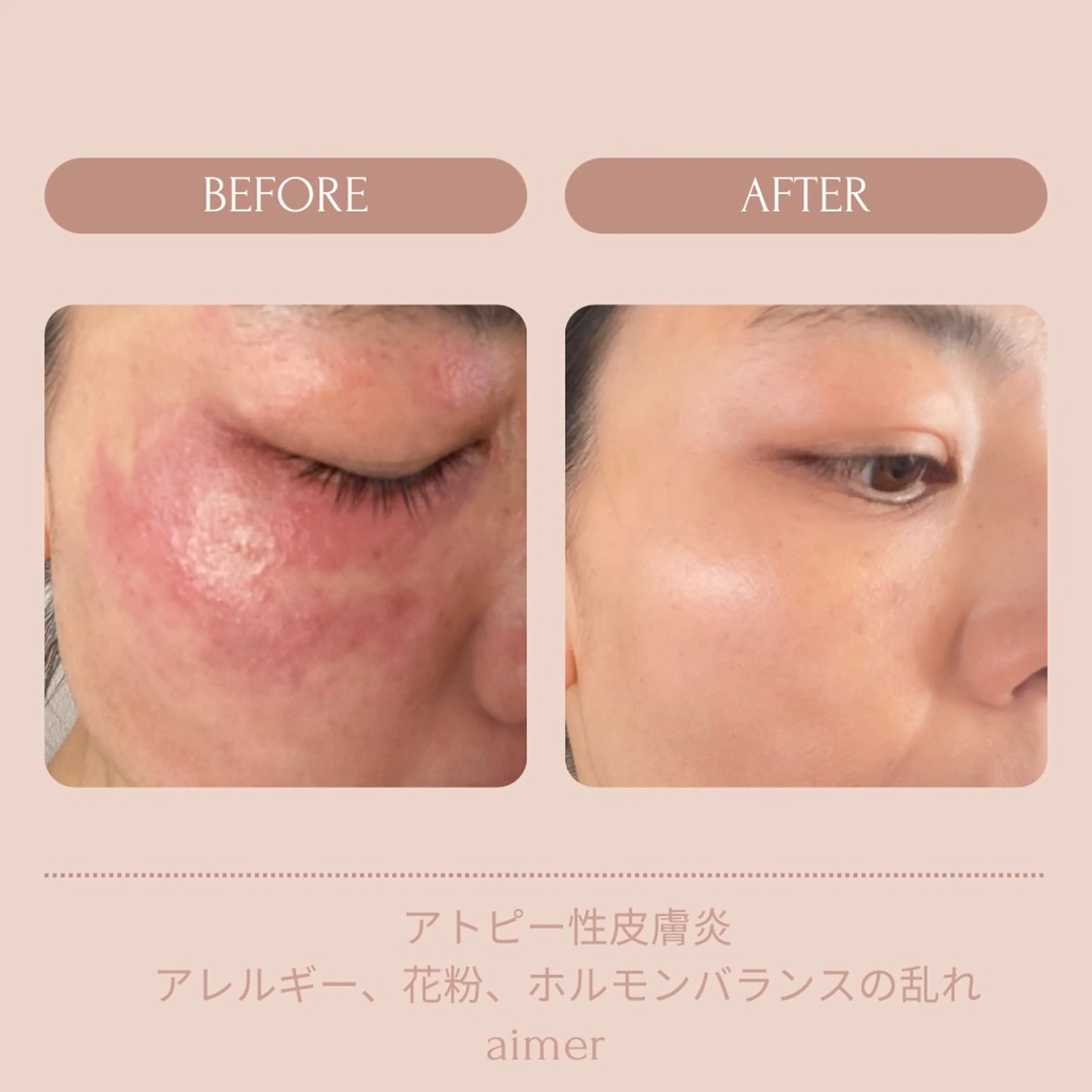 エステ aimer beautyのエステ・リラクイメージ